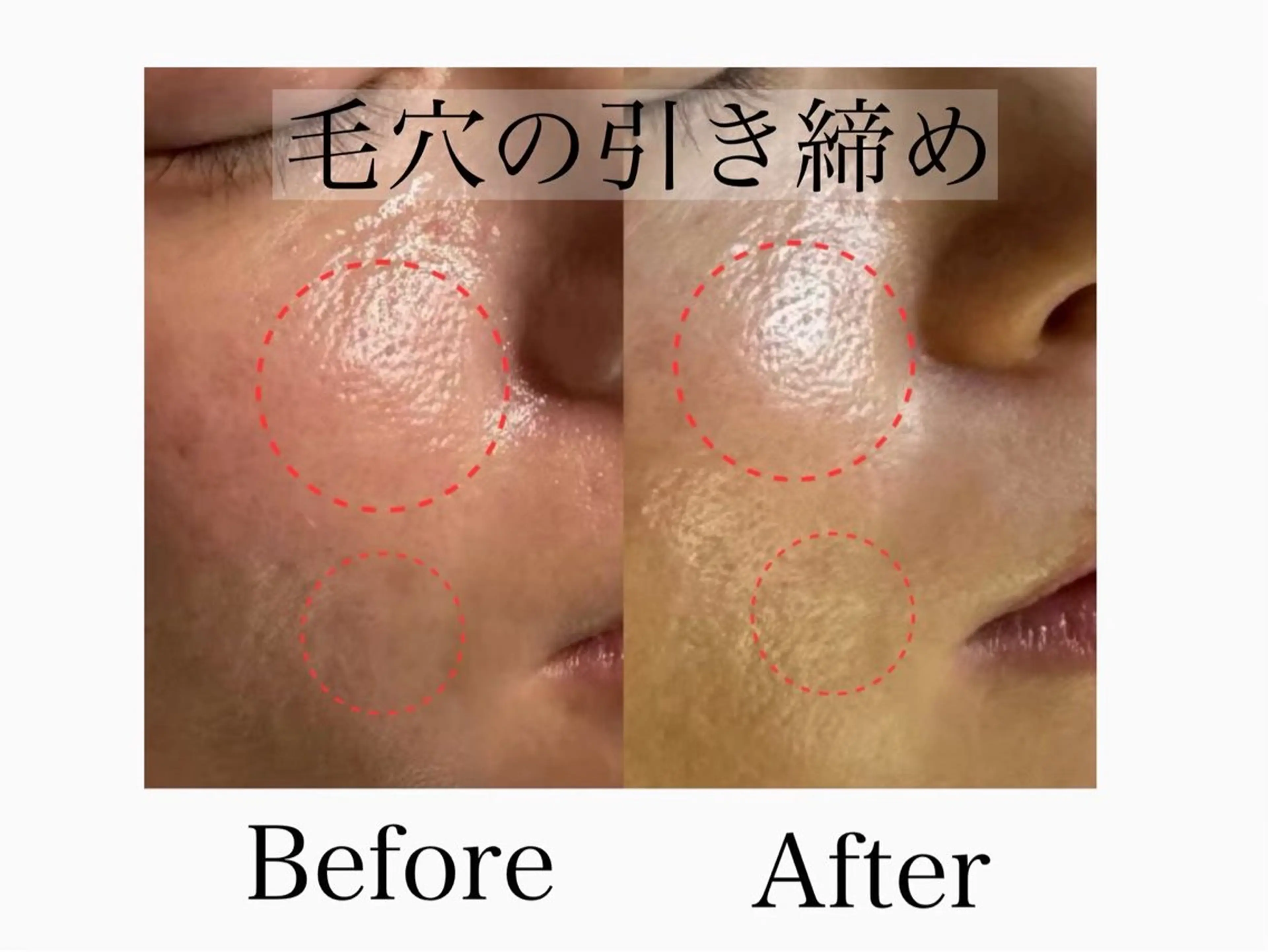 エステ 六本木/似合わせ眉毛 andＳ🍀Yuriのエステ・リラクイメージ