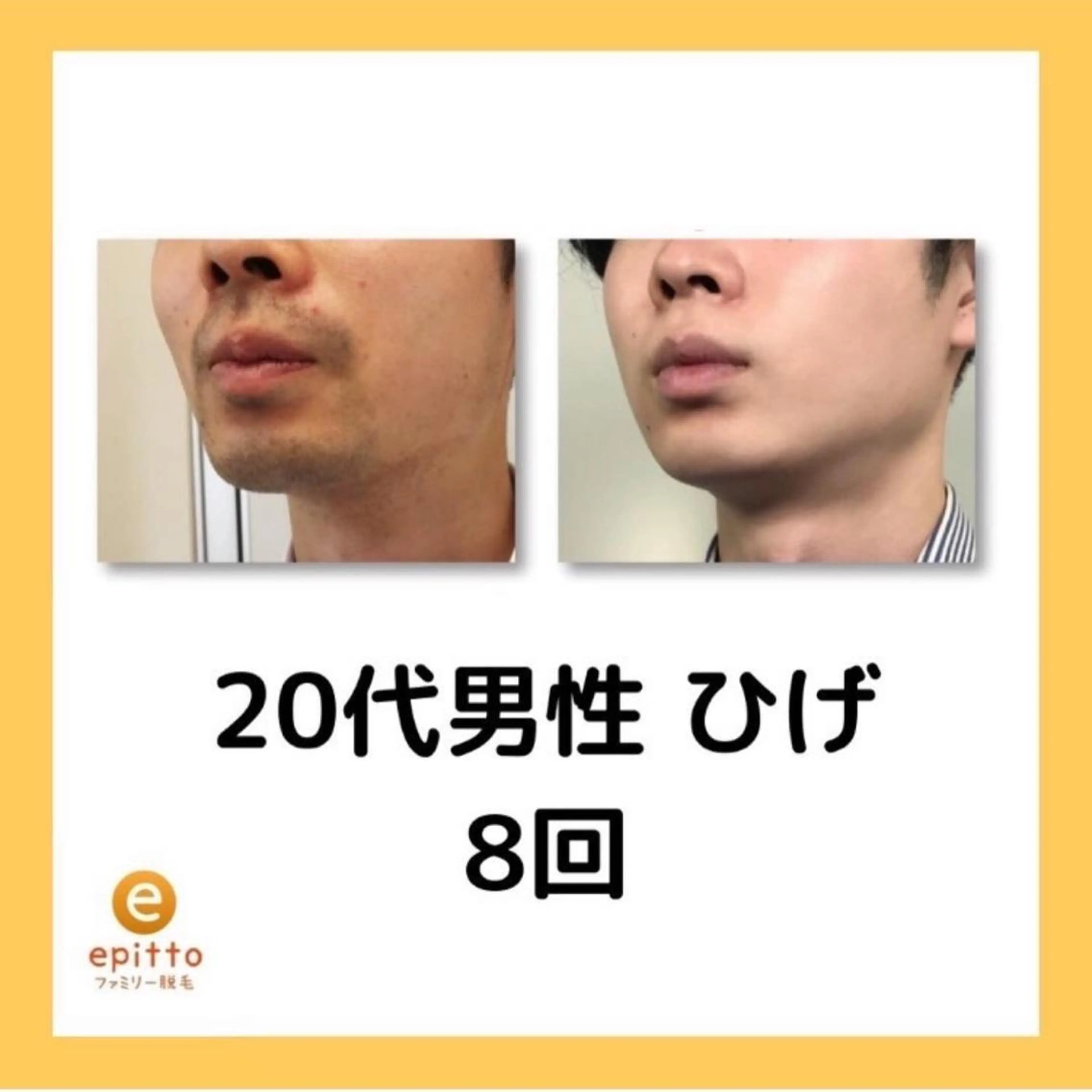 脱毛 エピット横浜磯子店所属・エピット横浜磯子店 大森のエステ・リラクイメージ