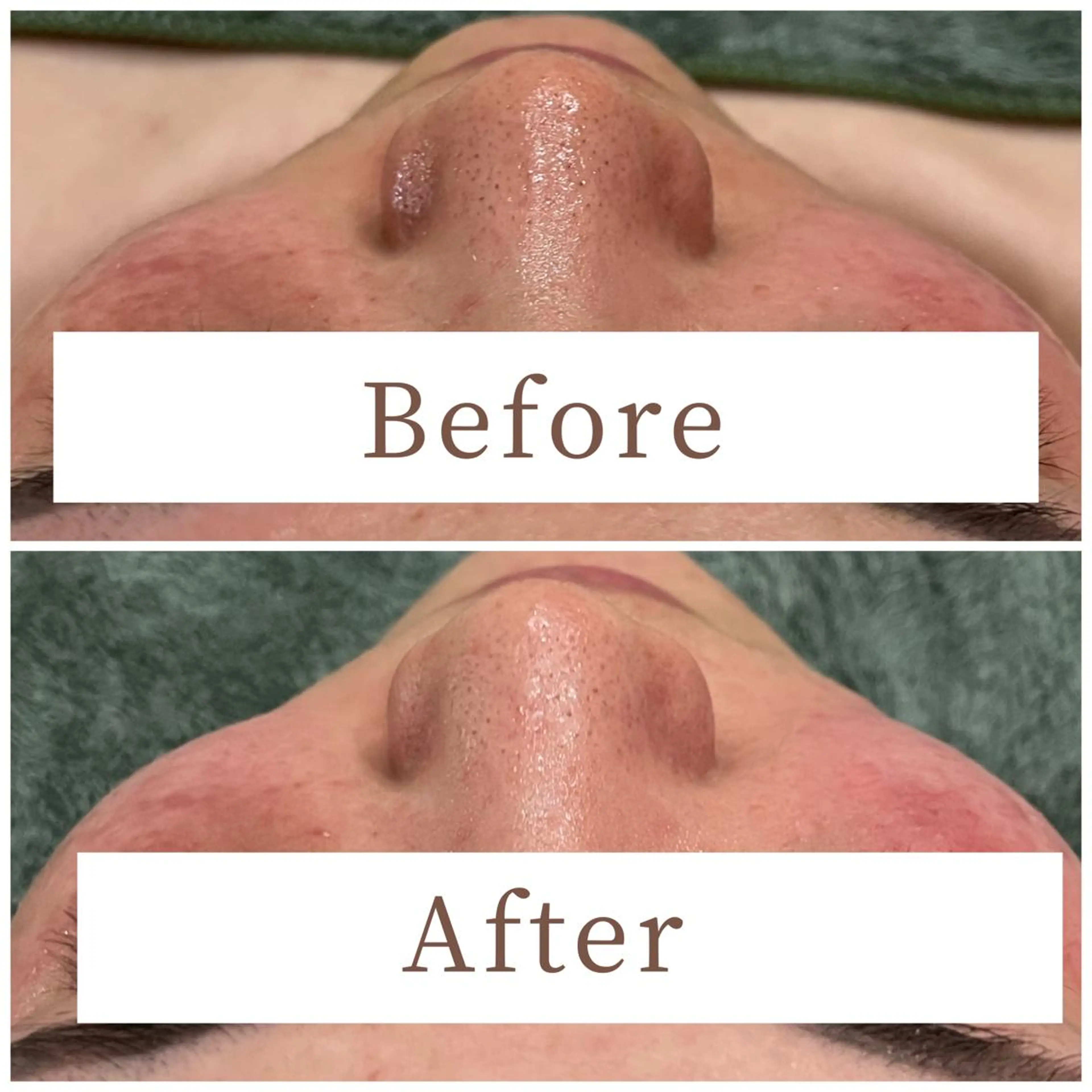 ハーブピーリング専門 muro.のエステ・リラクイメージ