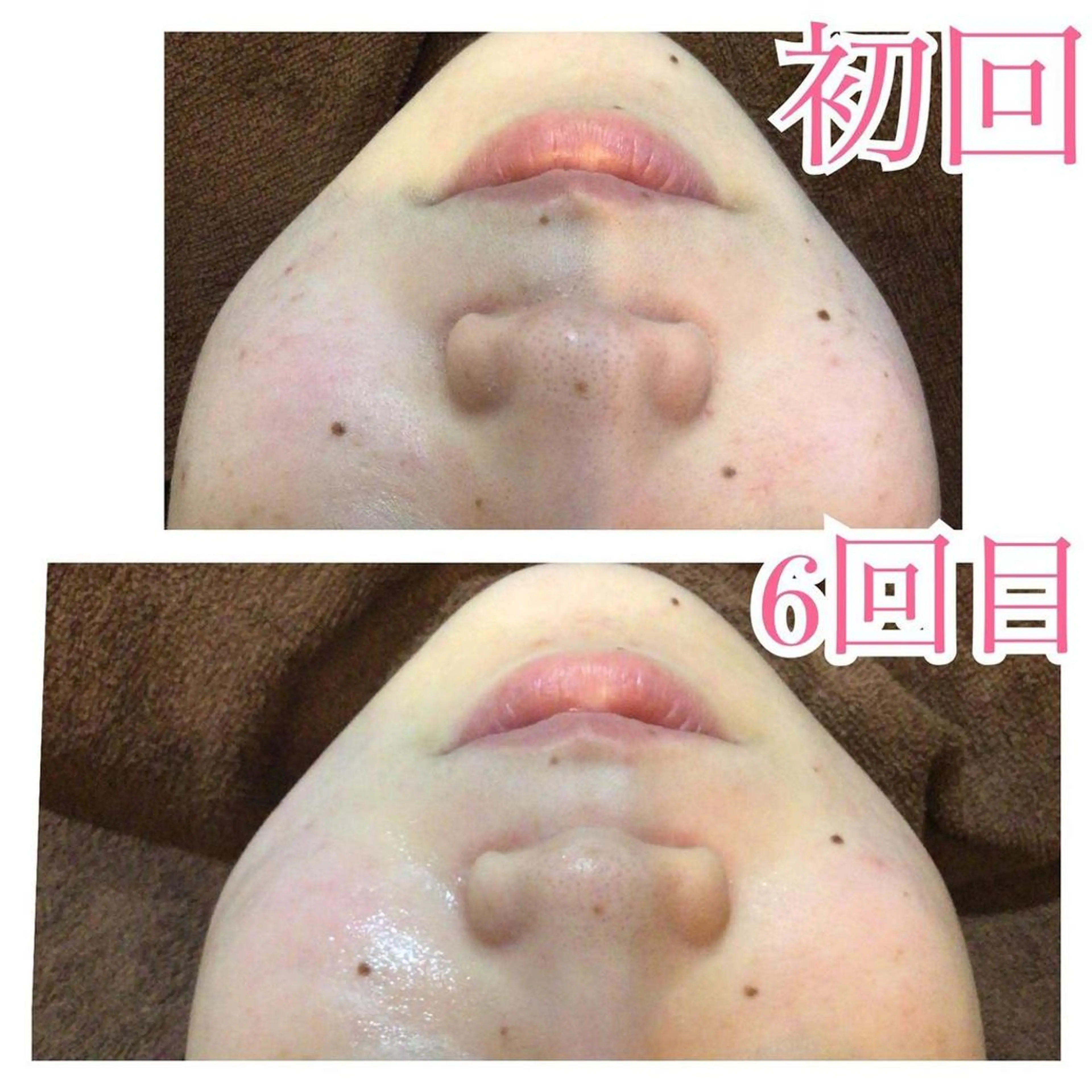 エステ リラク エヴァーグレース 河原町店のエステ・リラクイメージ