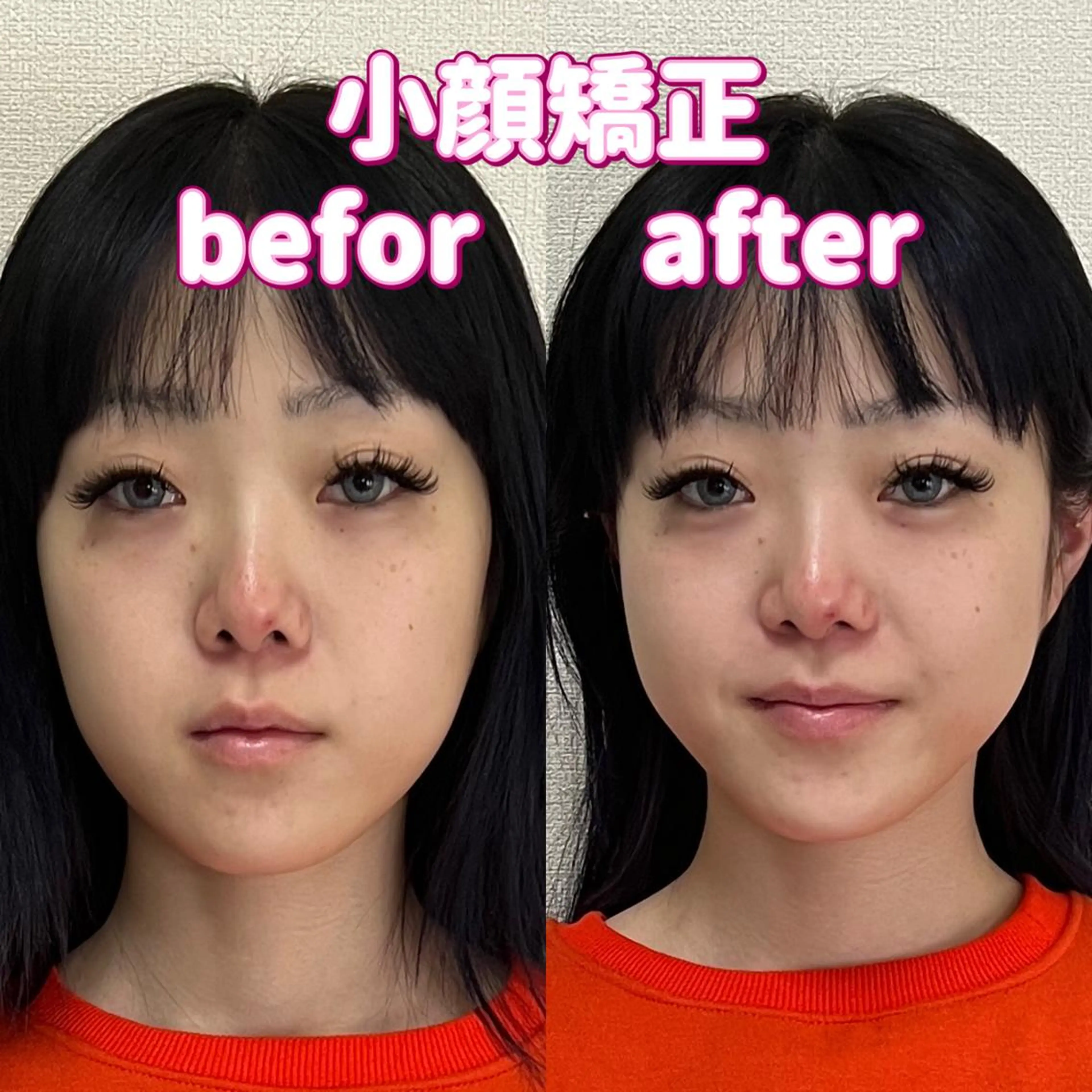 【小顔矯正】激変超人気の小顔矯正コース50分頭蓋骨から顔全体を調整します。の写真