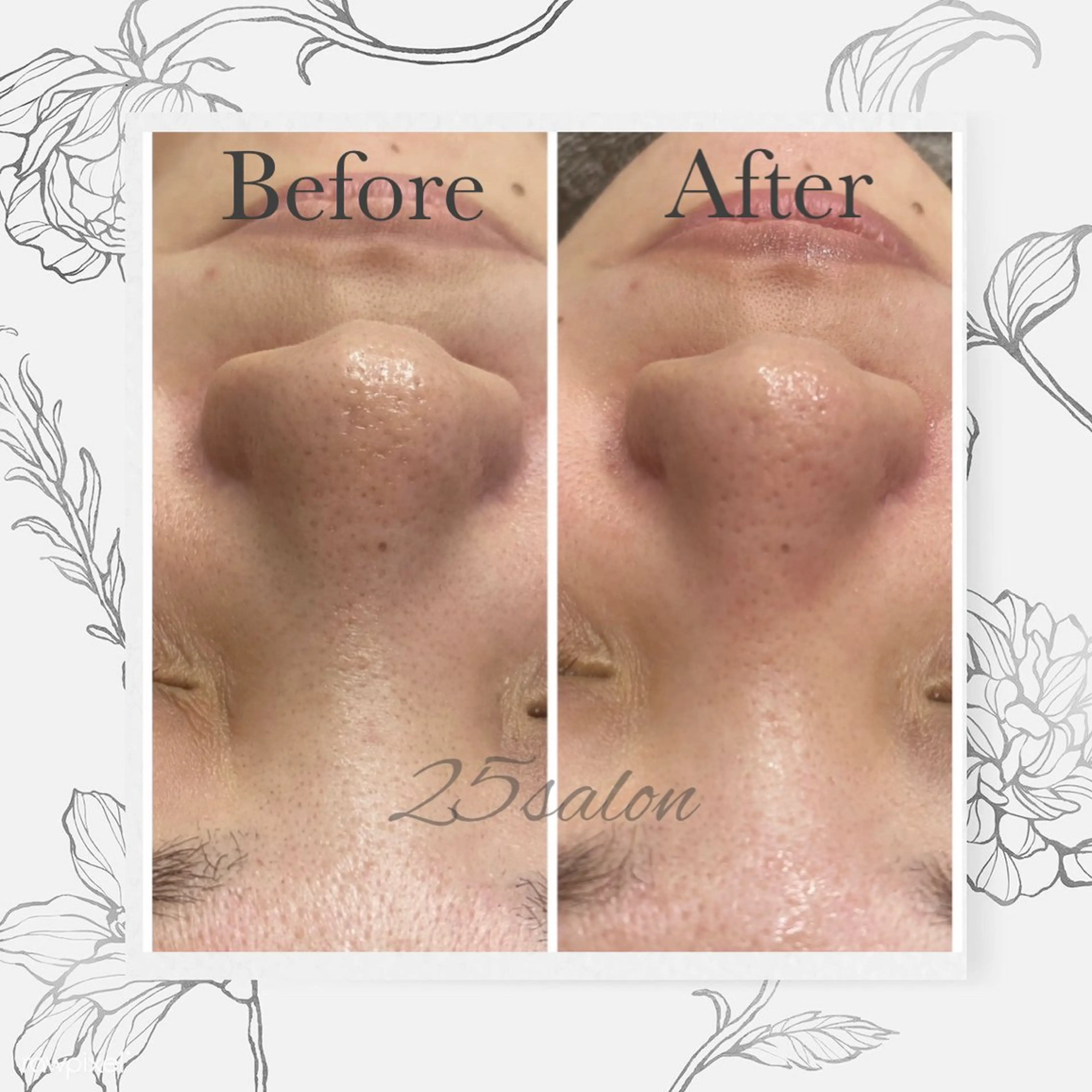 25salon所属・25salon MIHOのエステ・リラクイメージ