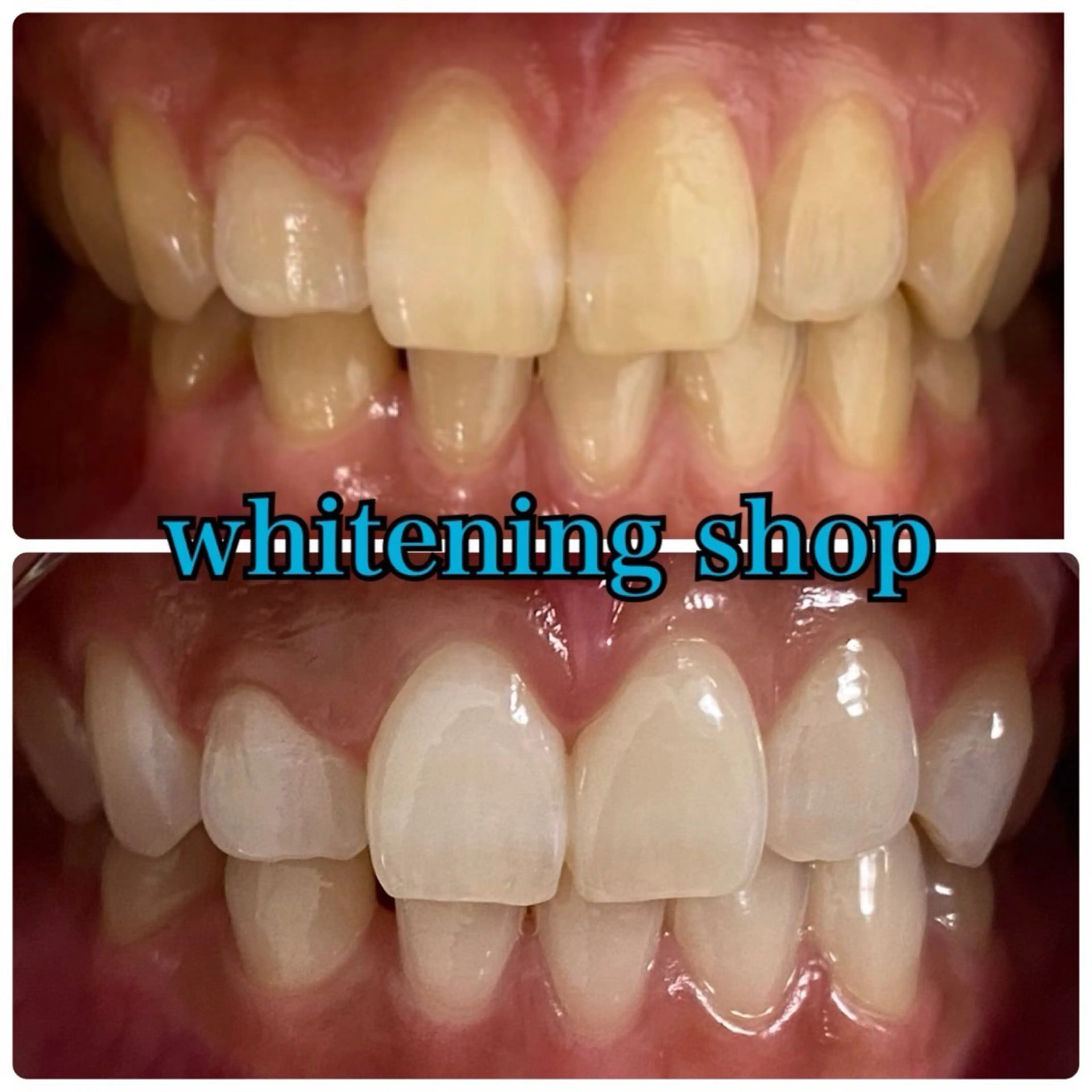 メンズ エステ リラク ホワイトニング ショップ川越店のエステ・リラクイメージ