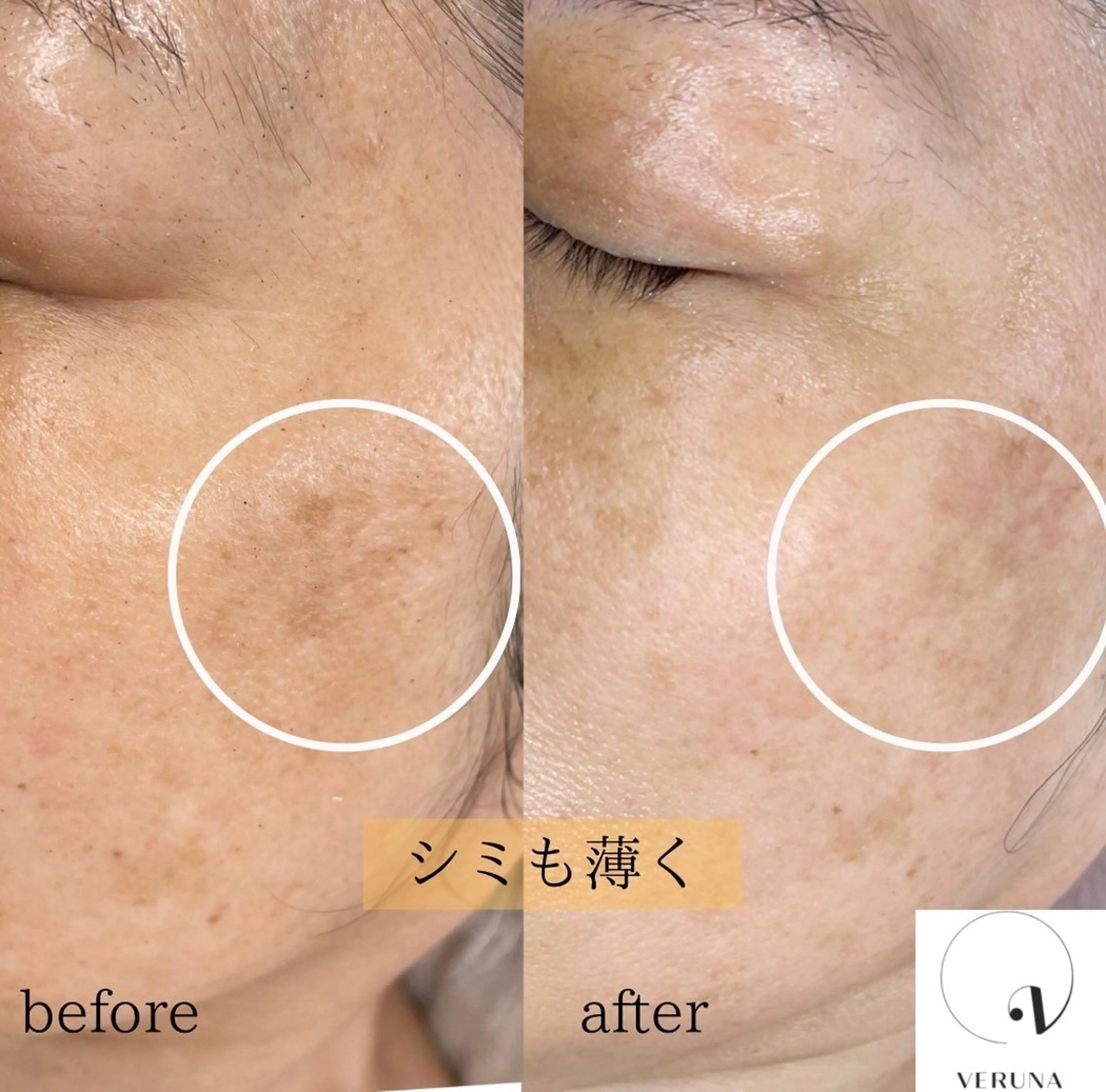 salon eminyのエステ・リラクイメージ