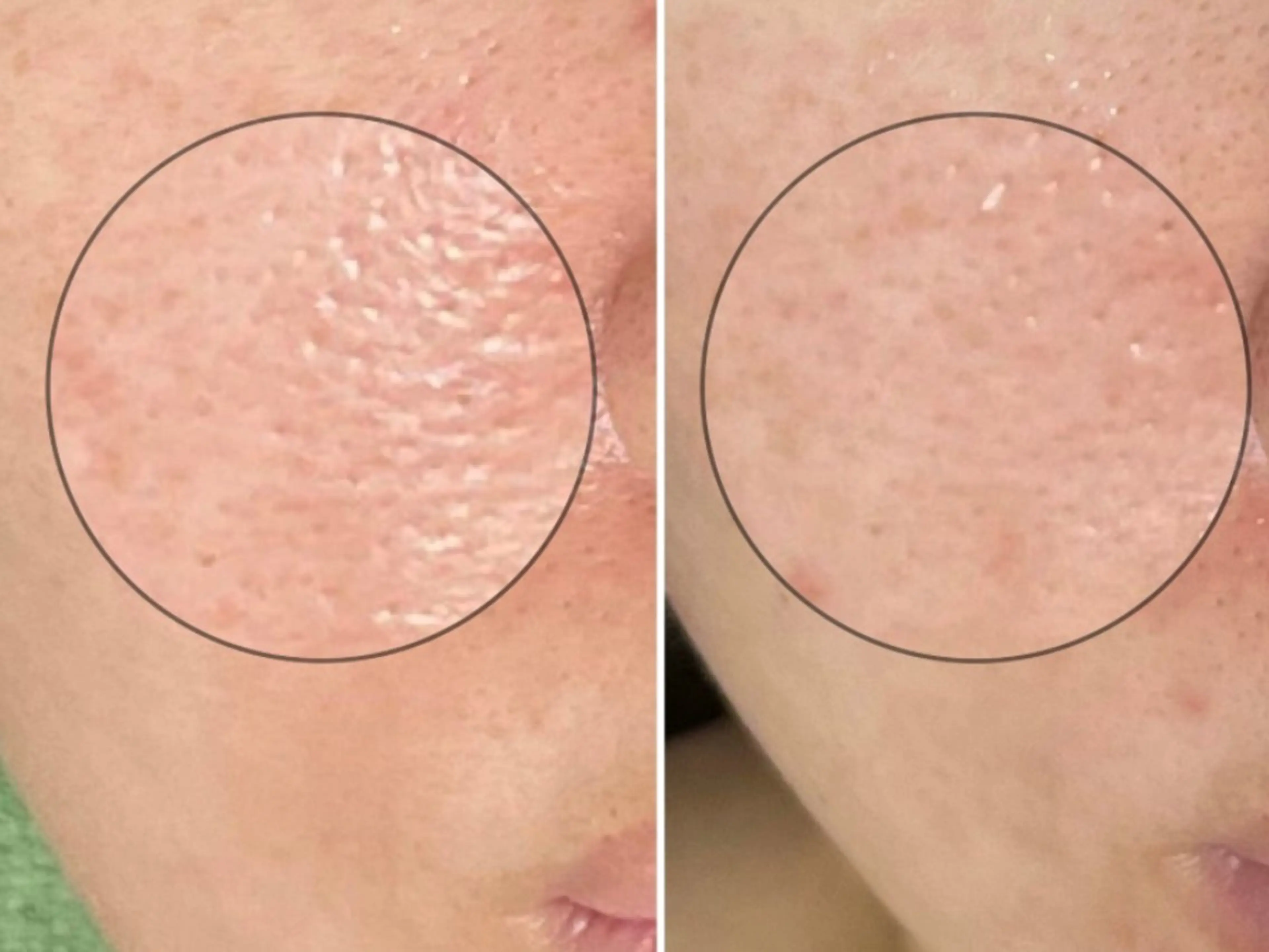 エステ SlowGarden 体質肌質改善サロンのエステ・リラクイメージ