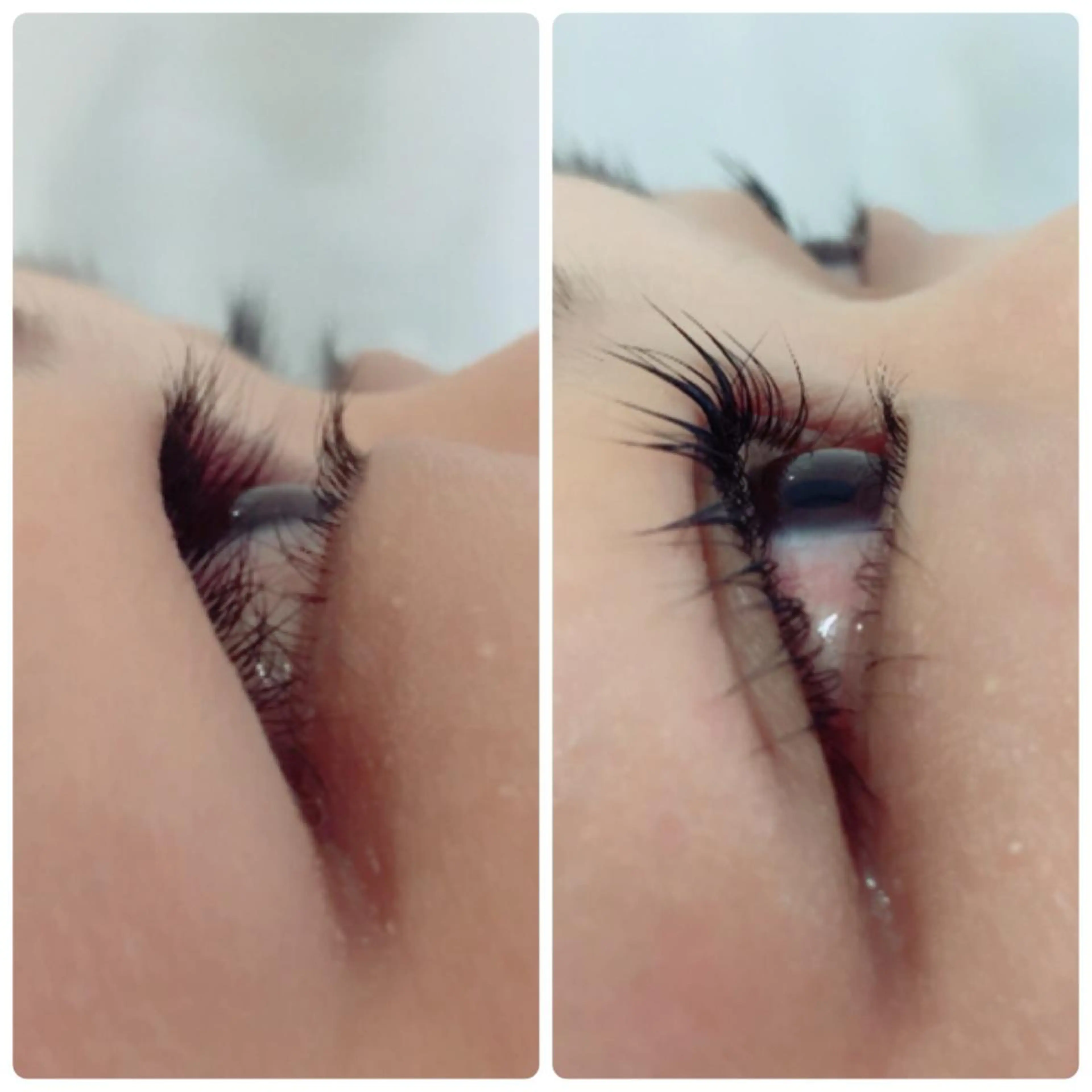 マツエク・マツパ まつげ、毛穴 TREEのエステ・リラクイメージ