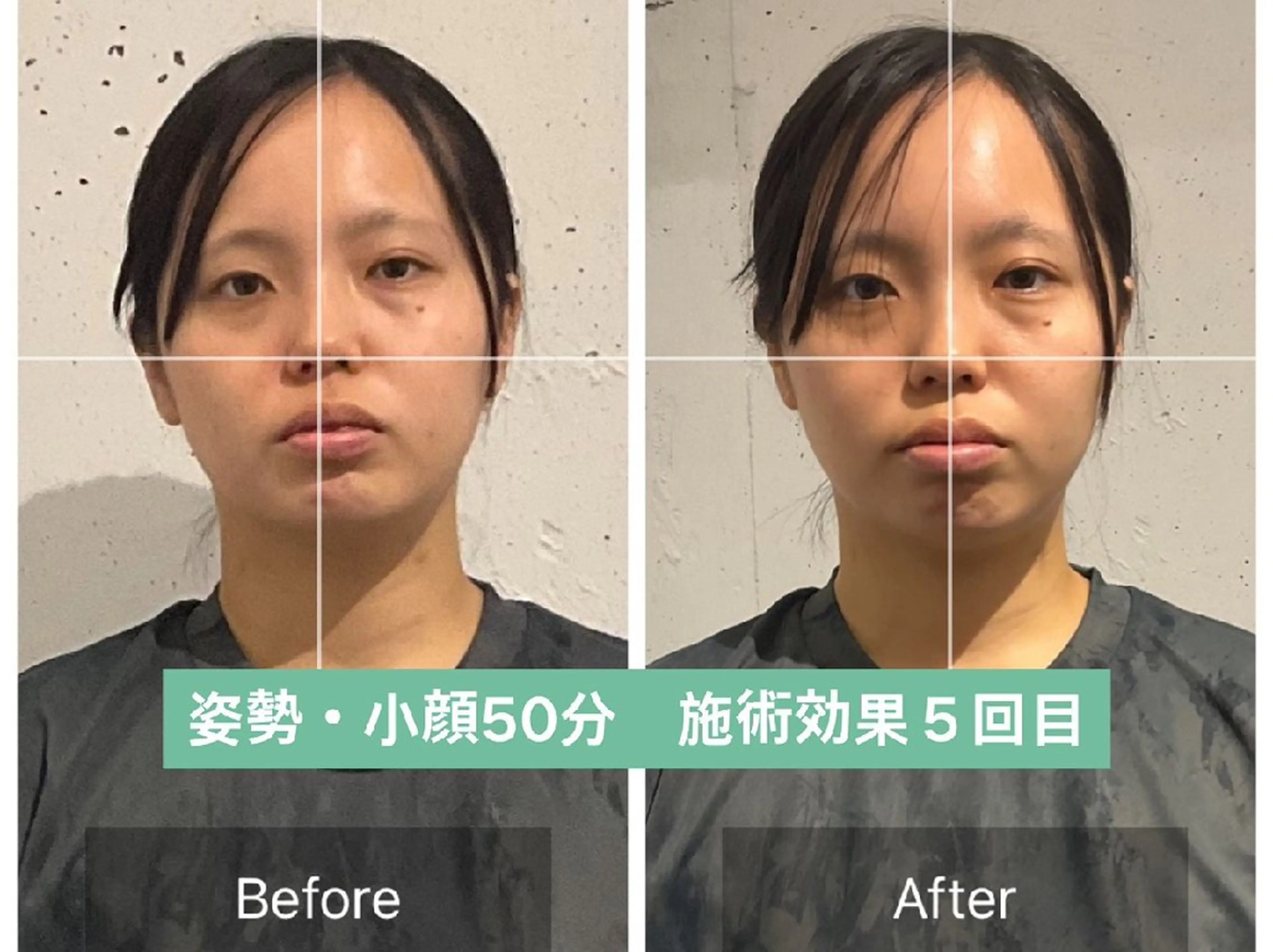 【歪み改善人気No.1】顔の歪み左右差&小顔矯正+姿勢矯正【50分17900→1000】※先着3名の写真