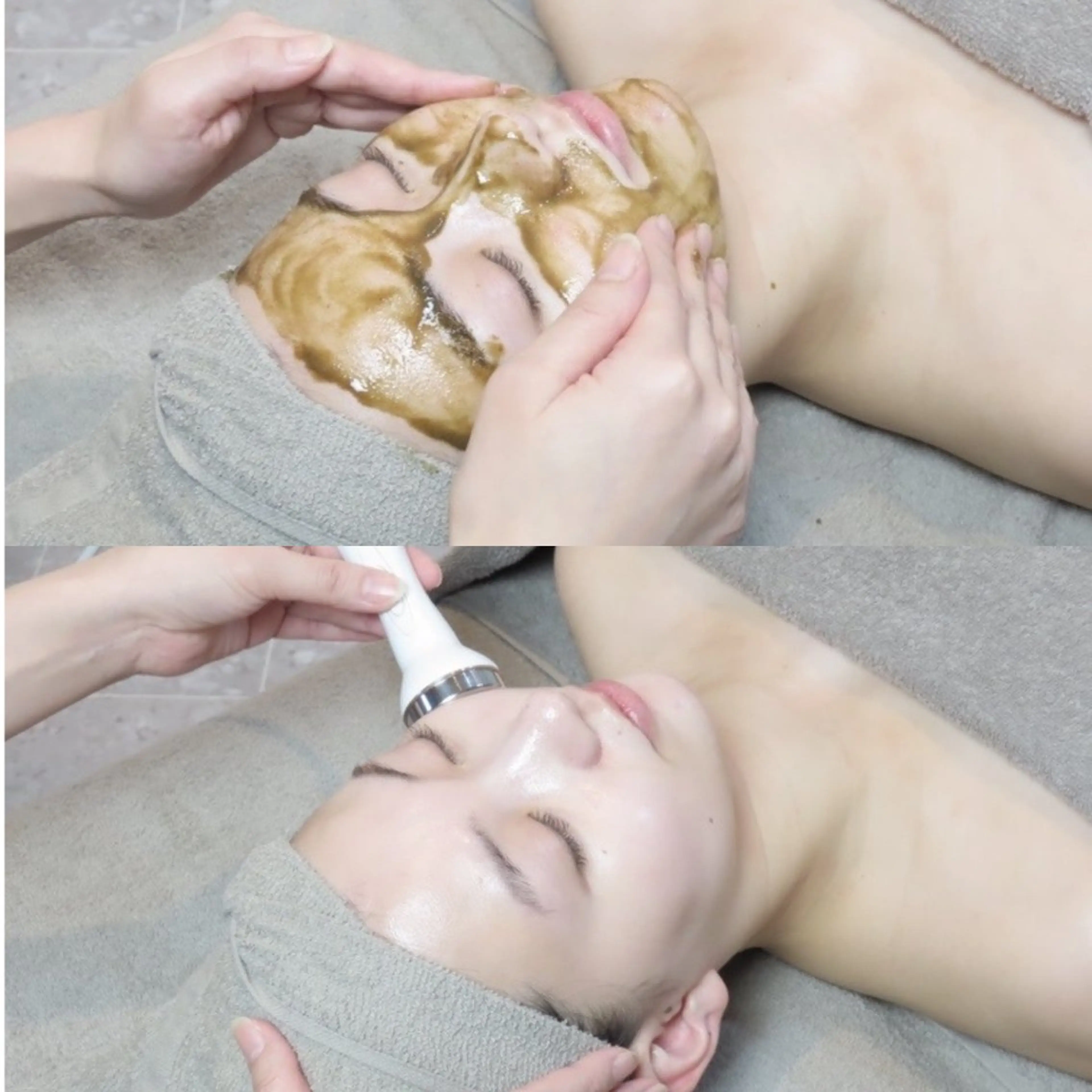 好評につき❣️12月も延長🎄✨❣️【人気NO.1👑】毛穴レス✨幹細胞ハーブピーリング🌿＋ぷるぷる生プラセンタ導入の写真