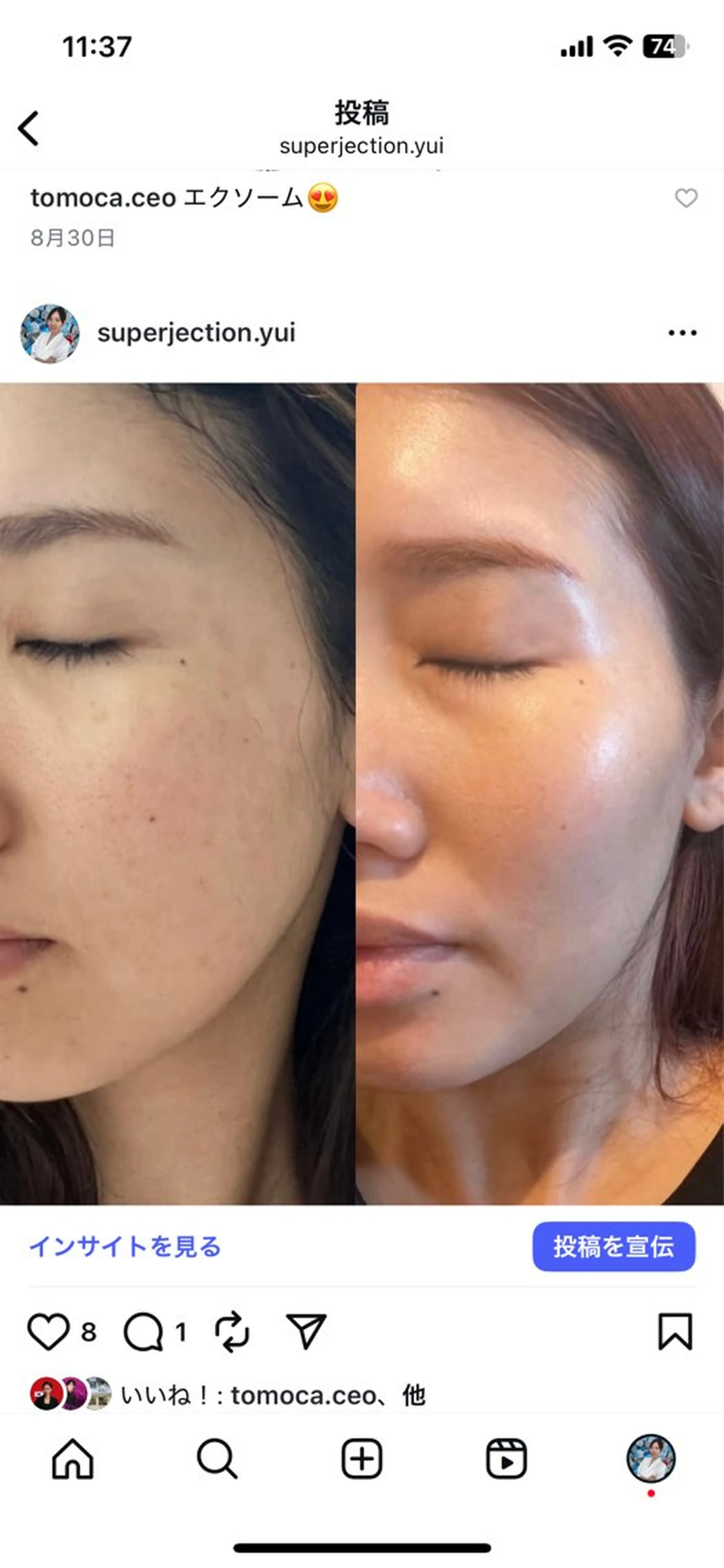 Monreve所属・美人スイッチdiet スーパージェクションのその他イメージ