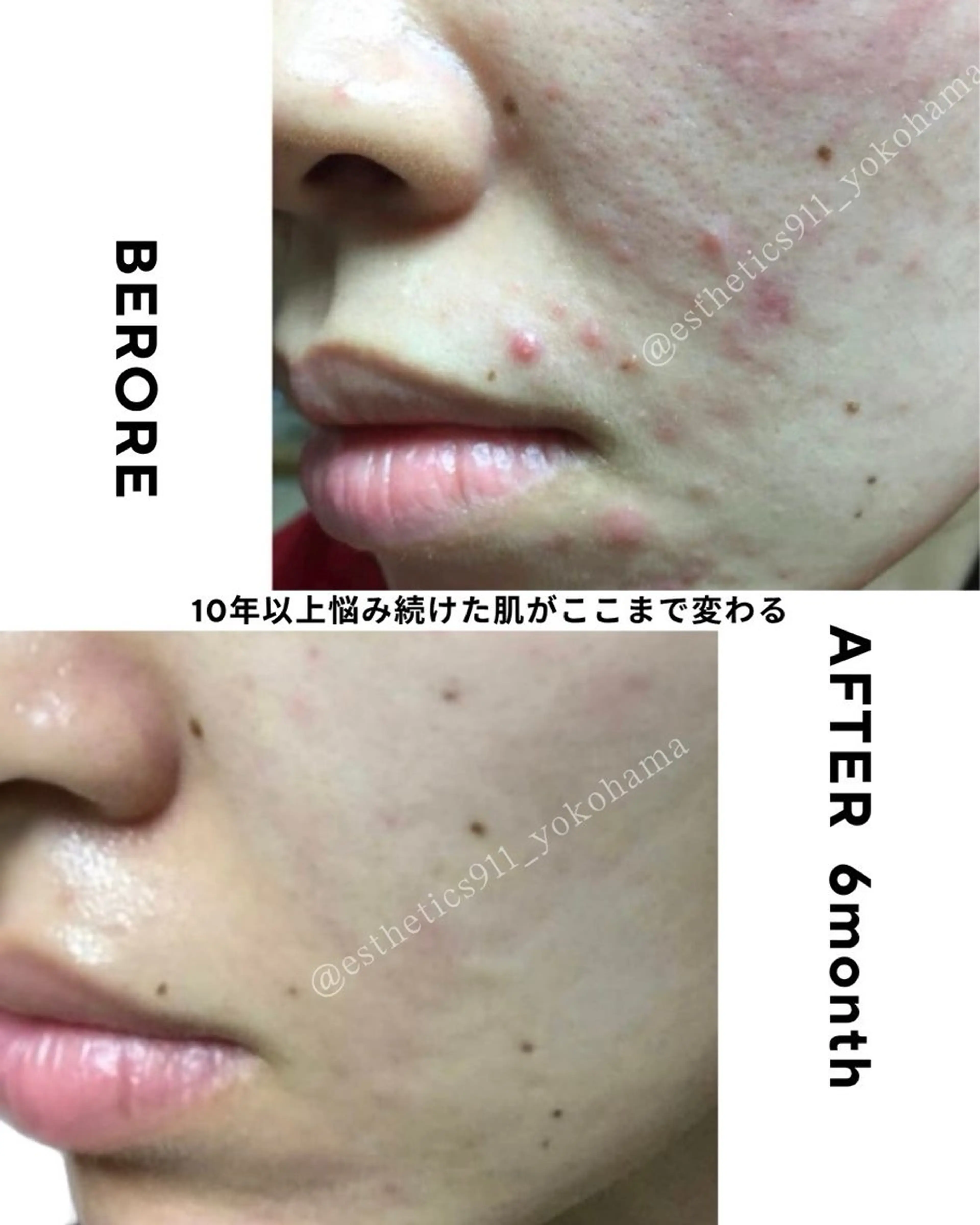 エステ リラク Esthetics 911横浜のエステ・リラクイメージ