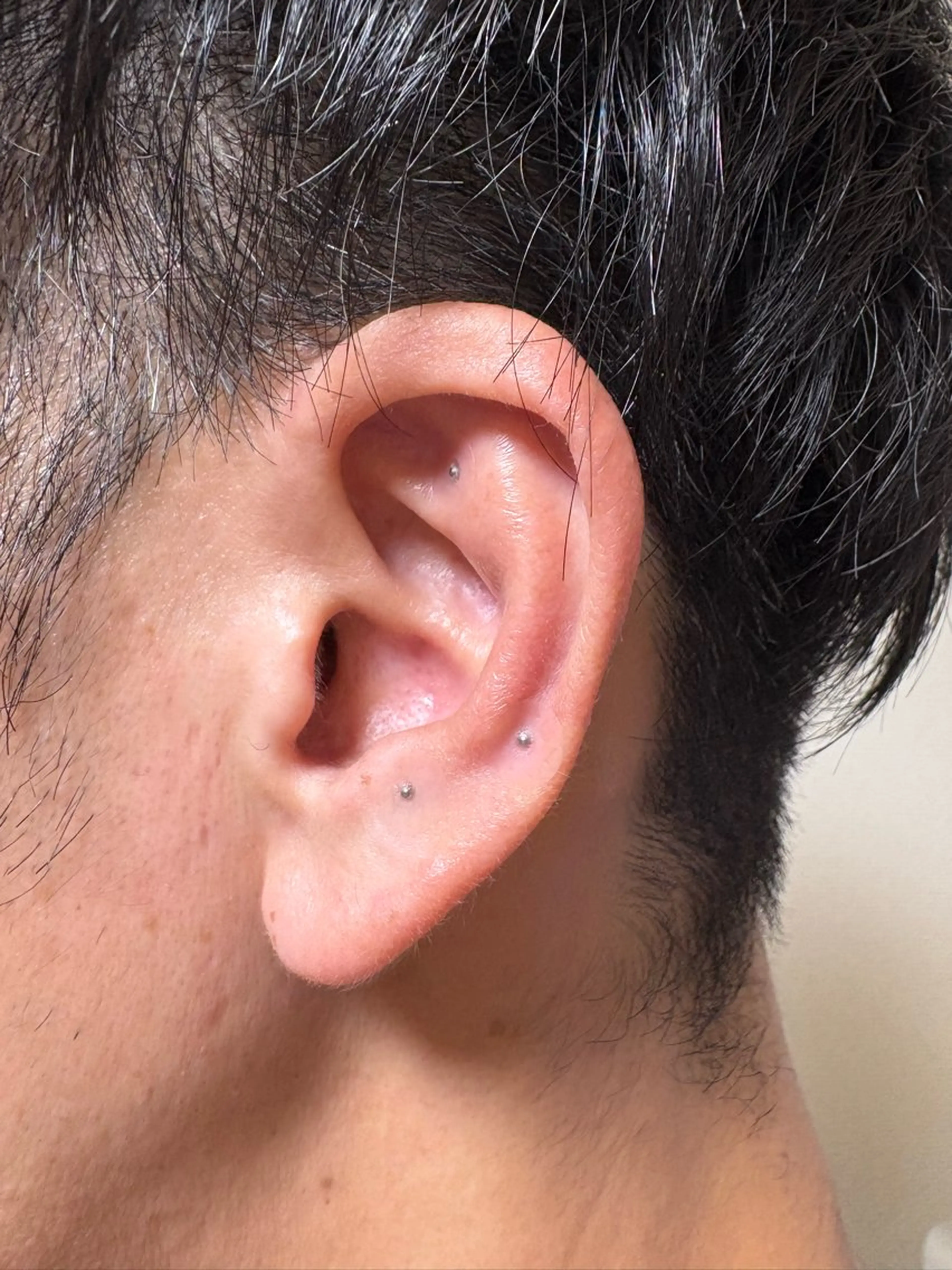 【身体バランスケア】耳つぼケア（ジュエリーなし粒タイプ）の写真