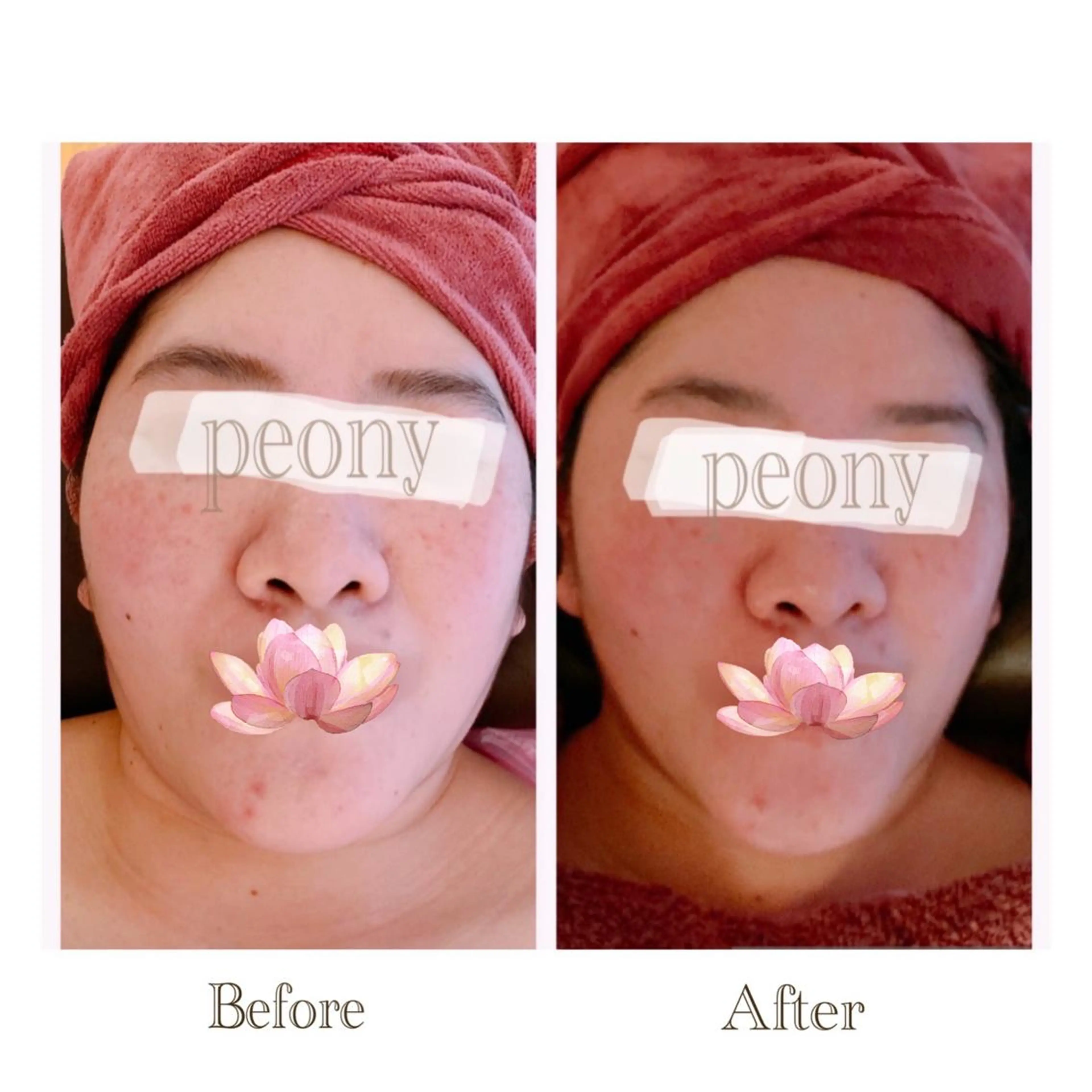 エステ デトックス美容専門サロンｐｅｏｎｙ所属・デトックス美容専門 サロンｐｅｏｎｙのエステ・リラクイメージ