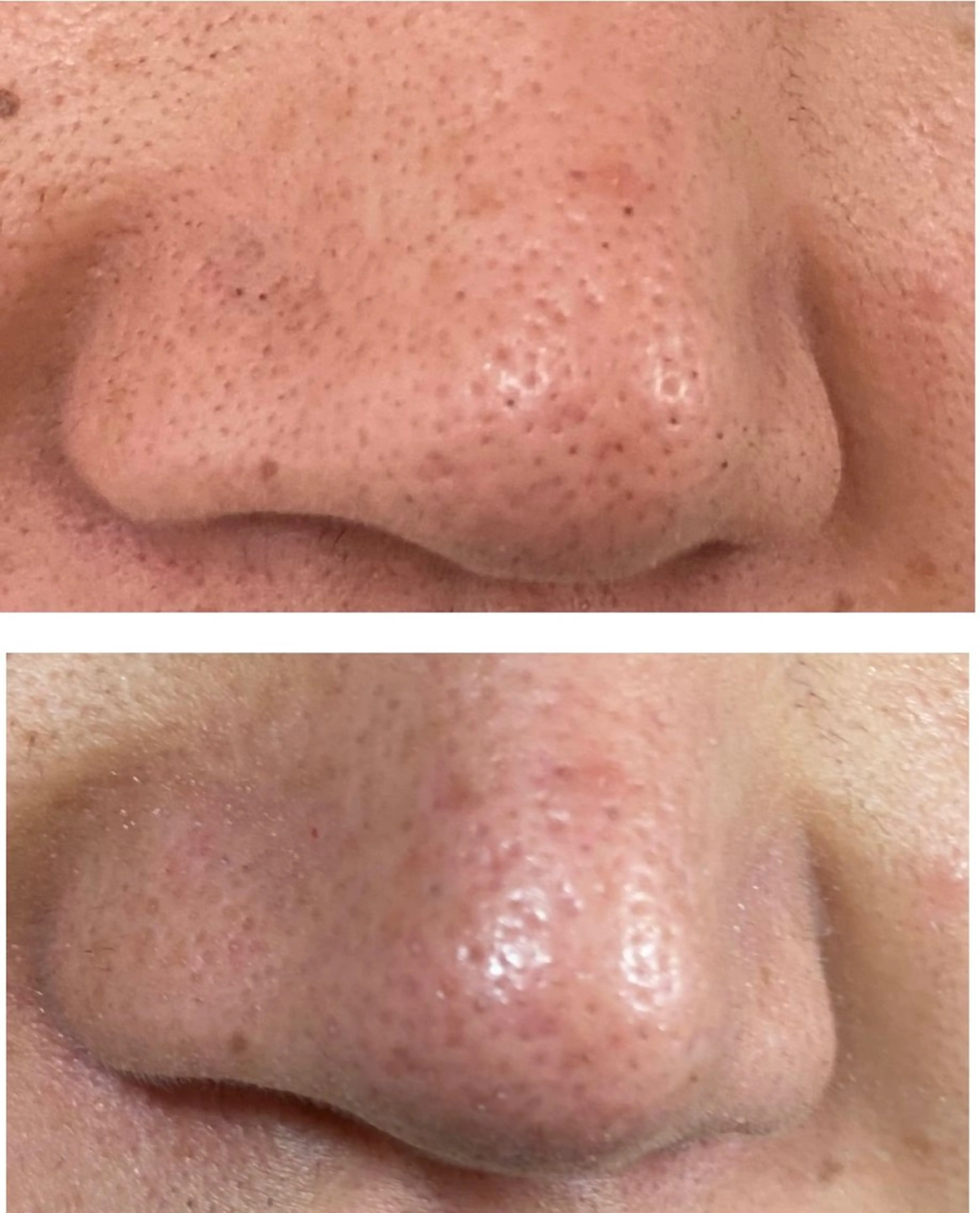 メンズ RE:moom リムーム/脱毛エステのエステ・リラクイメージ