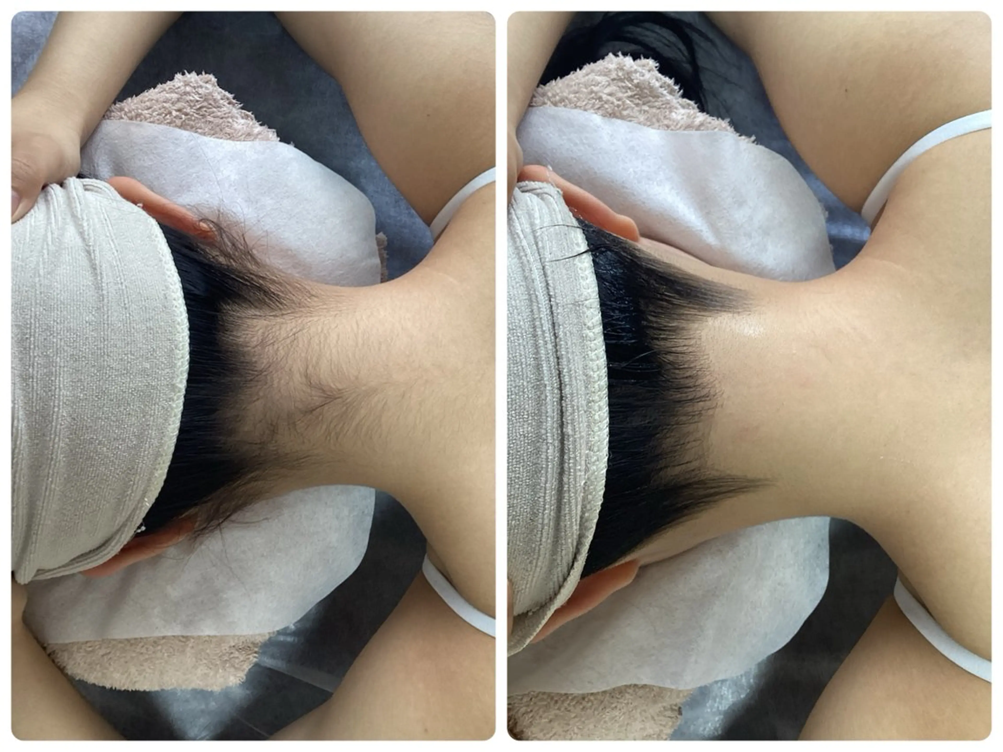 脱毛 脱毛専門減毛サロン LULU.tokyoのエステ・リラクイメージ