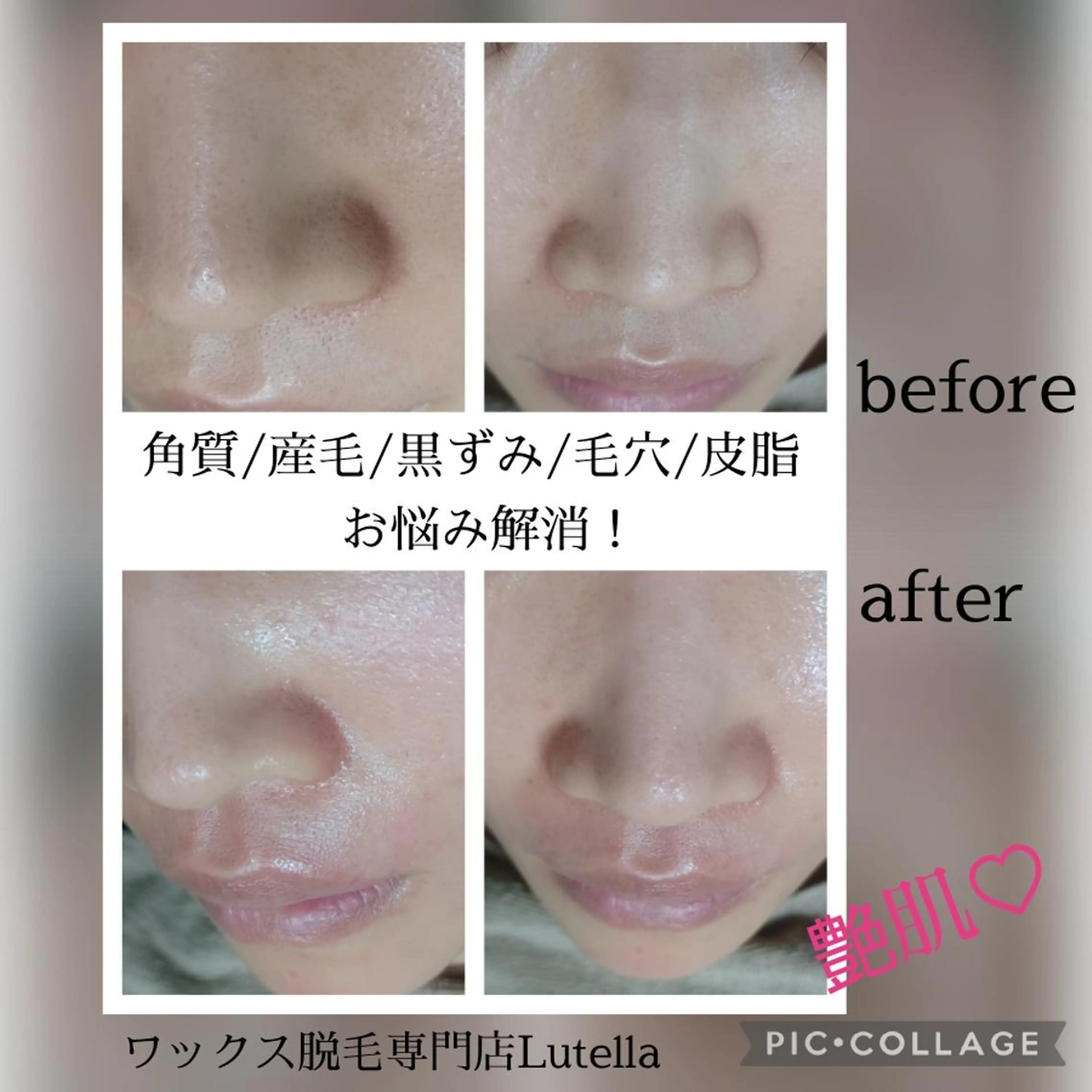Lutella所属・ワックス脱毛専門店 Lutellaのエステ・リラクイメージ
