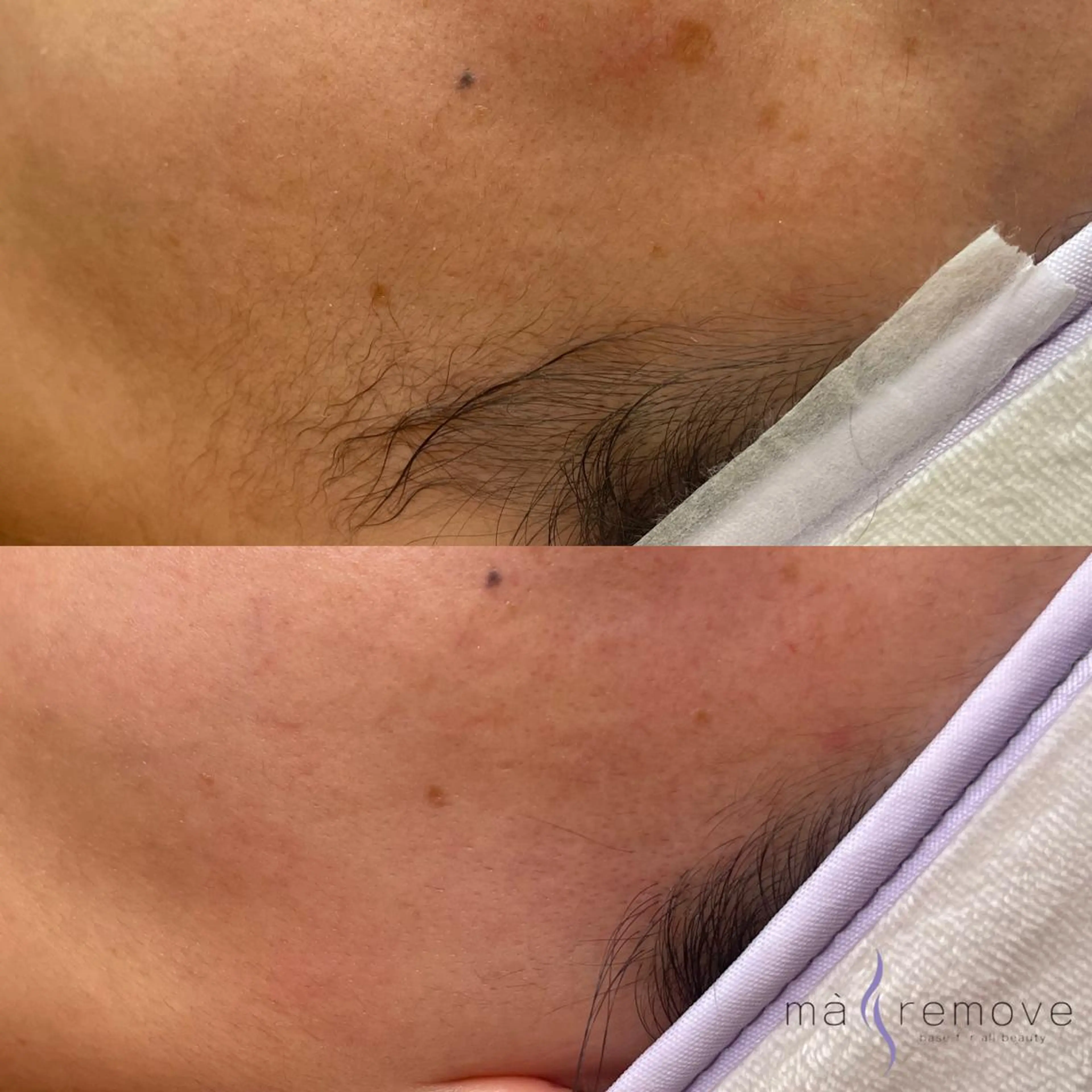 amu nail. RINAのネイルデザイン