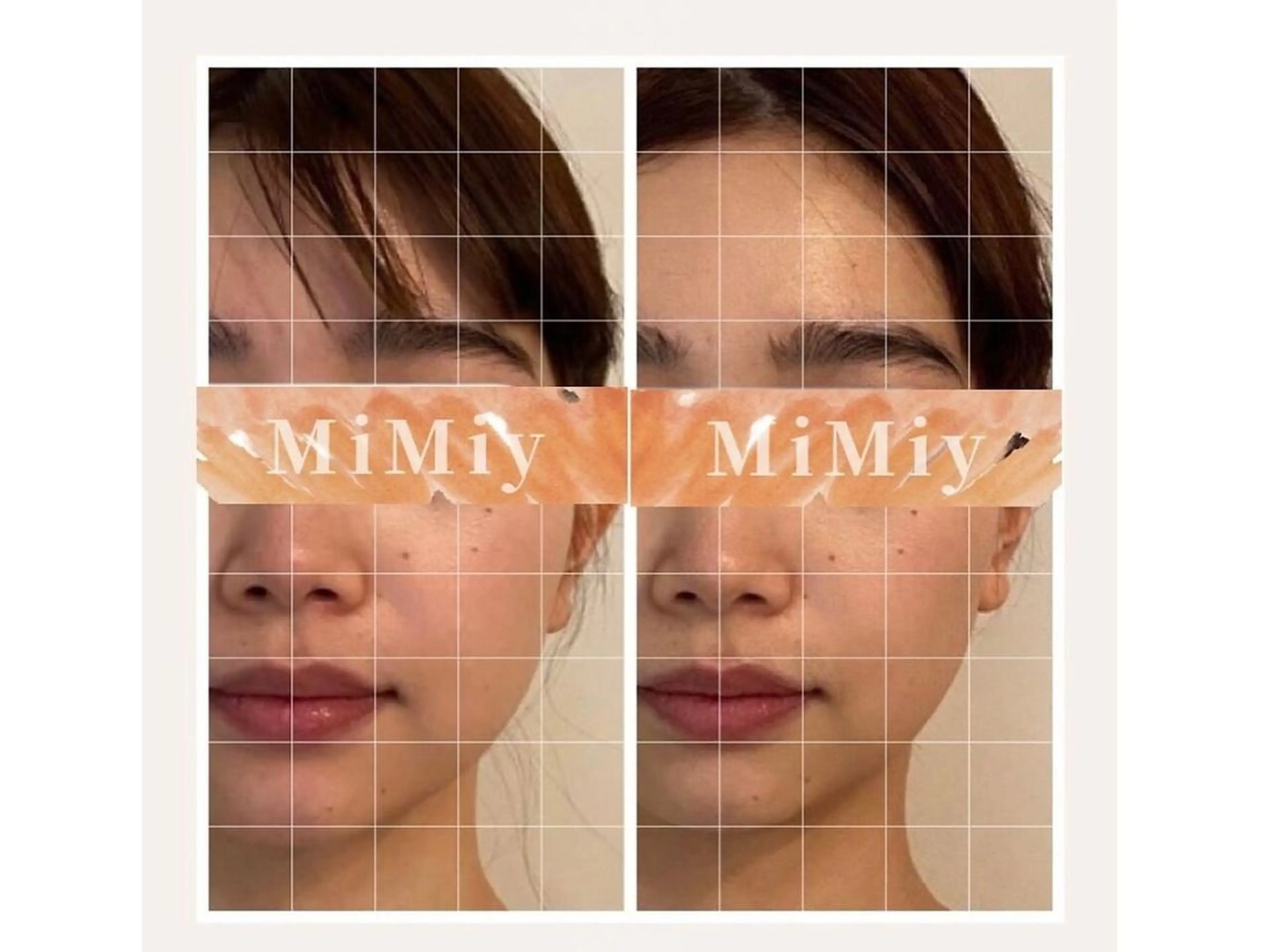 今だけ鼻周り毛穴洗浄付✨お帰りフェイスライン🙋‍♀️❣️【話題のデザインMSSF+肌質別パック】美肌も小顔もGET🌟の写真