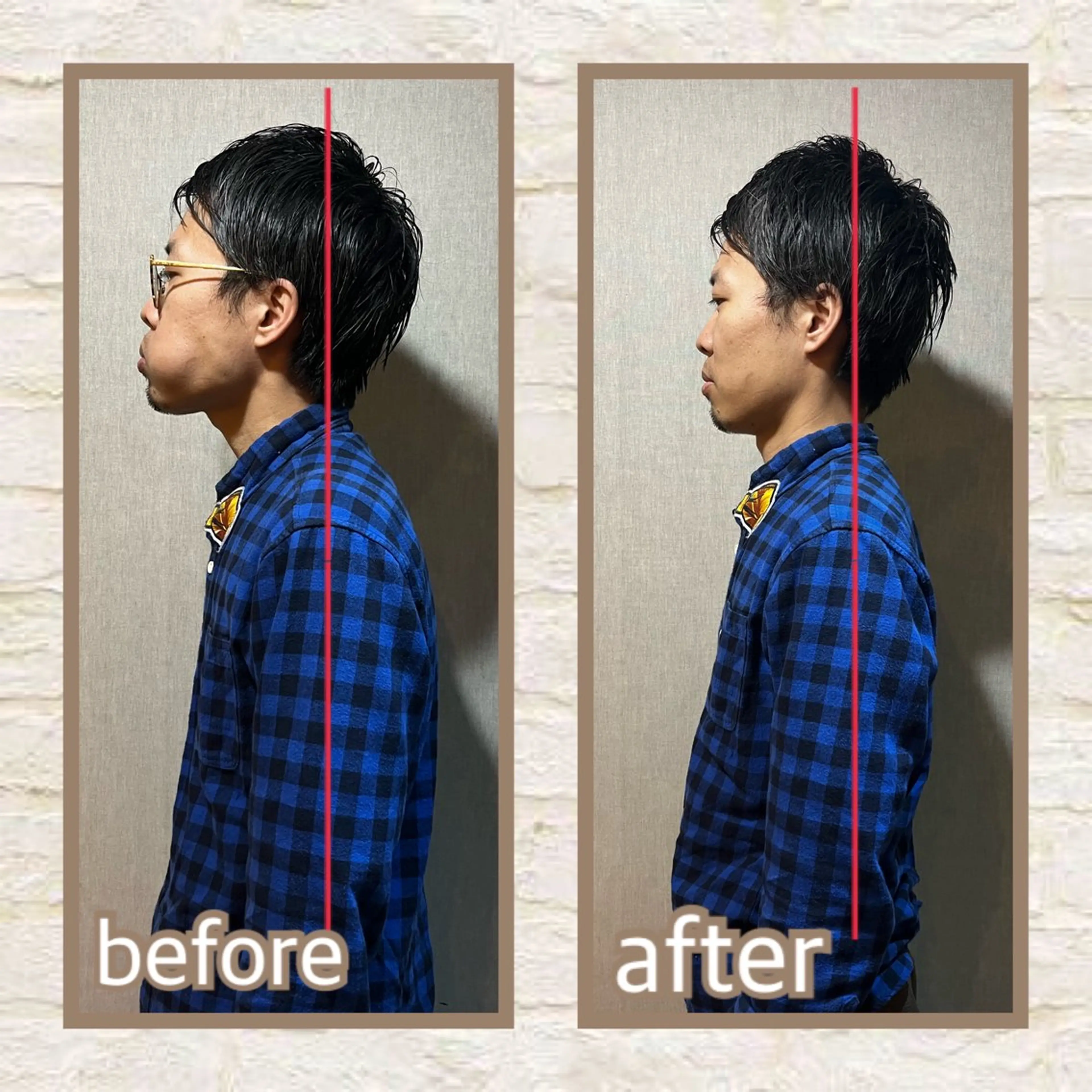 🔹頸椎矯正ストレッチ🔹肩こりからくる頭痛、目眩にお悩みの方必見！ストレートネックも改善✨の写真