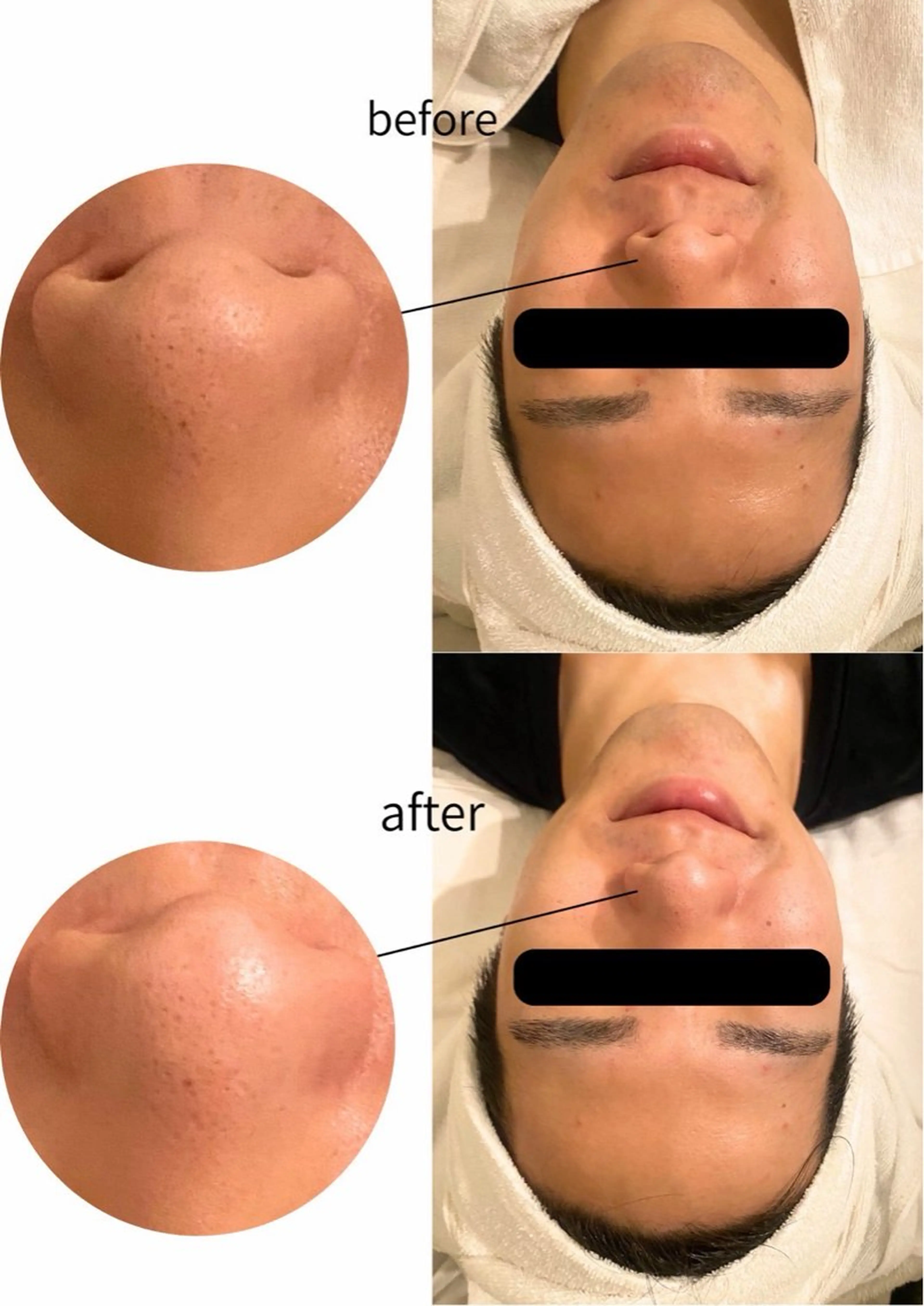 Pola R-isa 南船場所属・毛穴・くすみ・肩こり エステ/POLAのその他イメージ