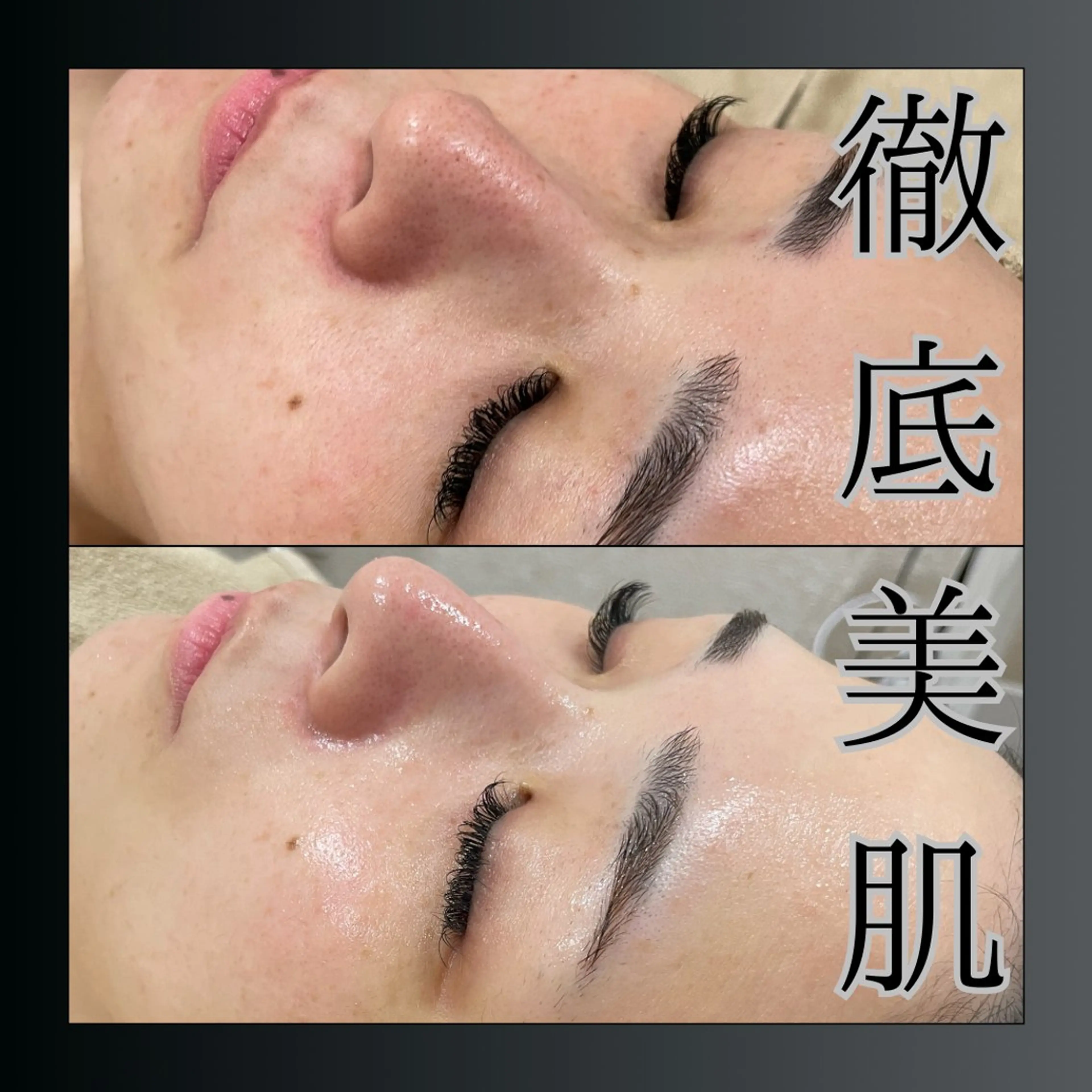 エステ LiZA エステティックサロンのその他イメージ