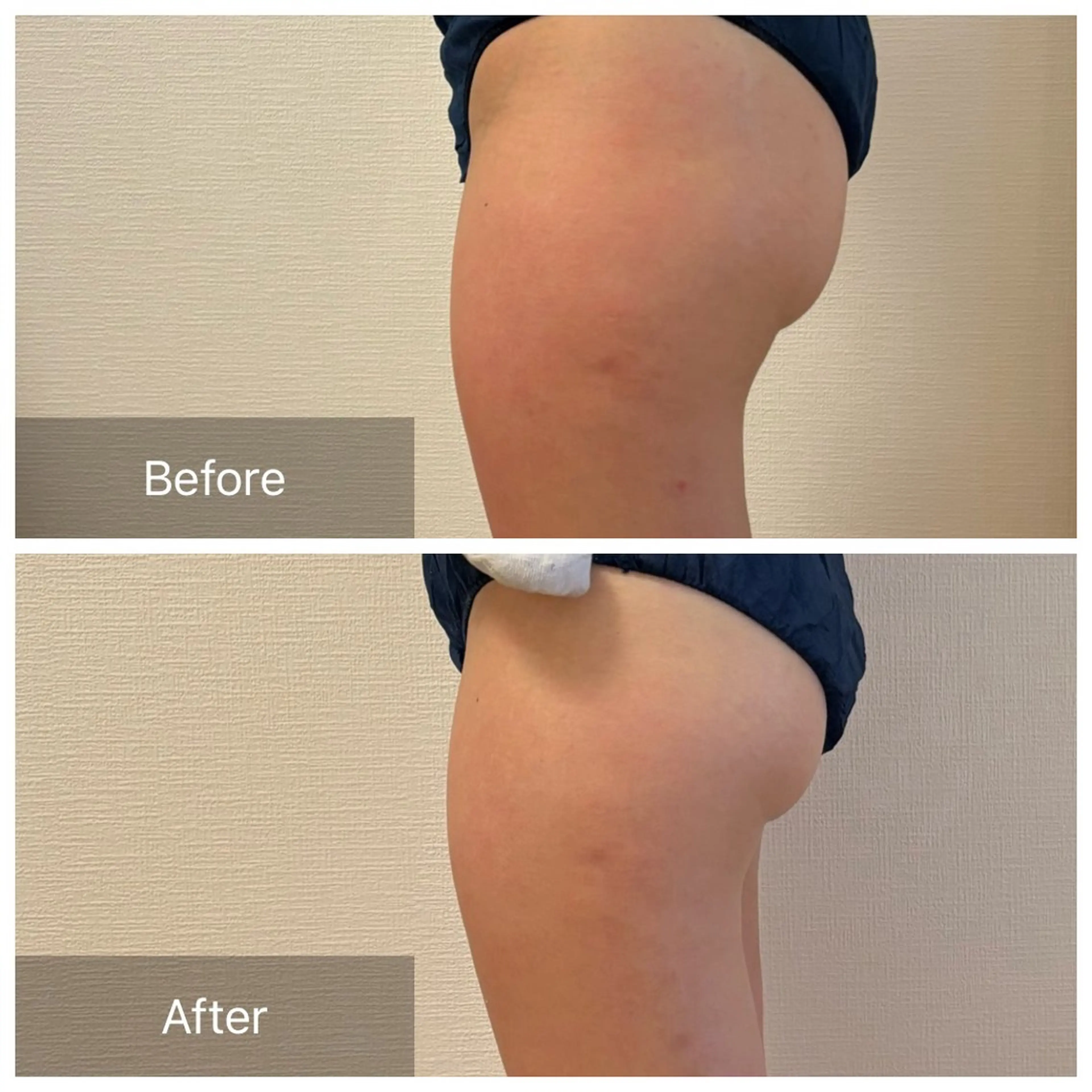 大阪大東市 / 体質・肌質改善サロン アンシャンテ所属・体質・肌質改善サロン アンシャンテのエステ・リラクイメージ