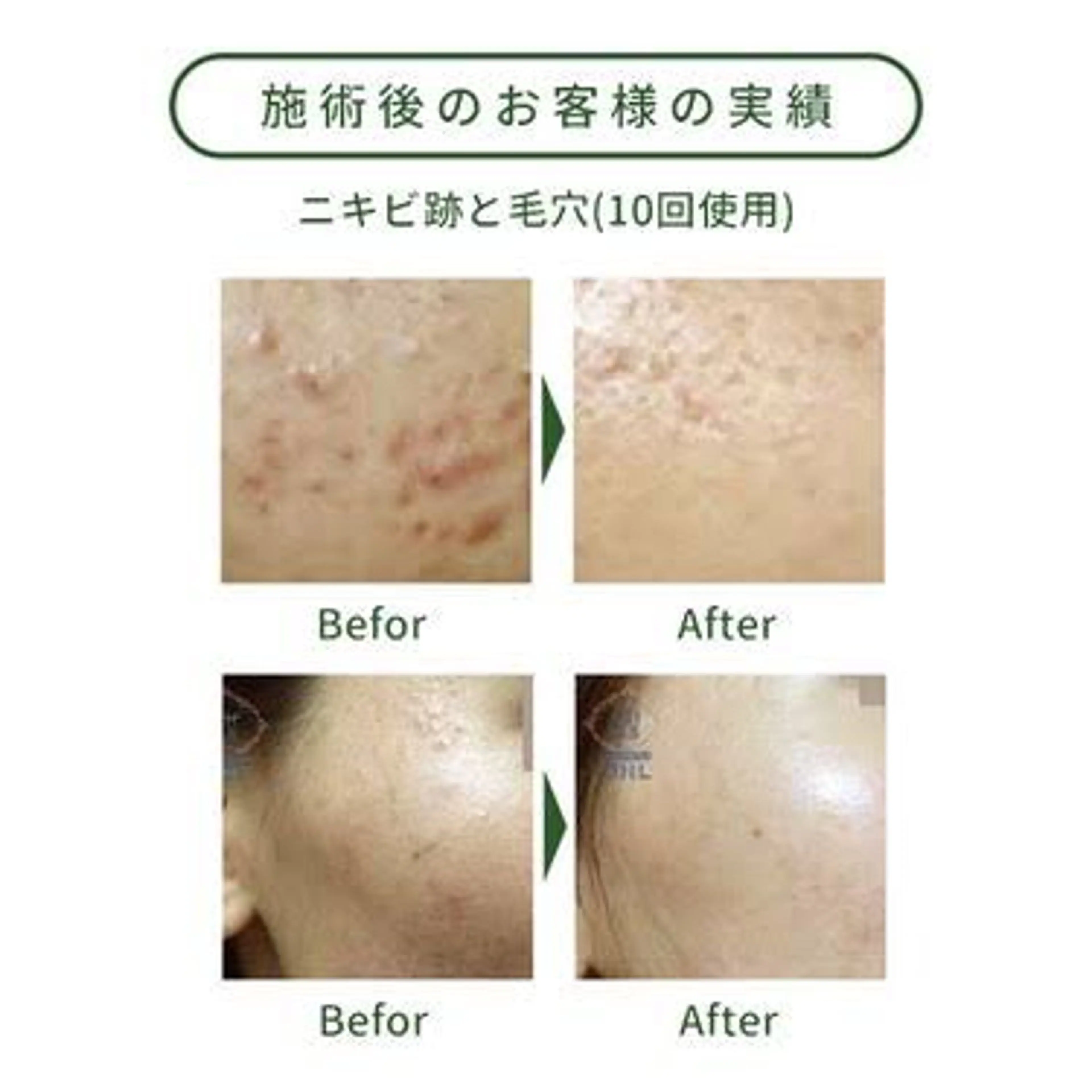 たるみ改善小顔エステ 堀葉月のその他イメージ