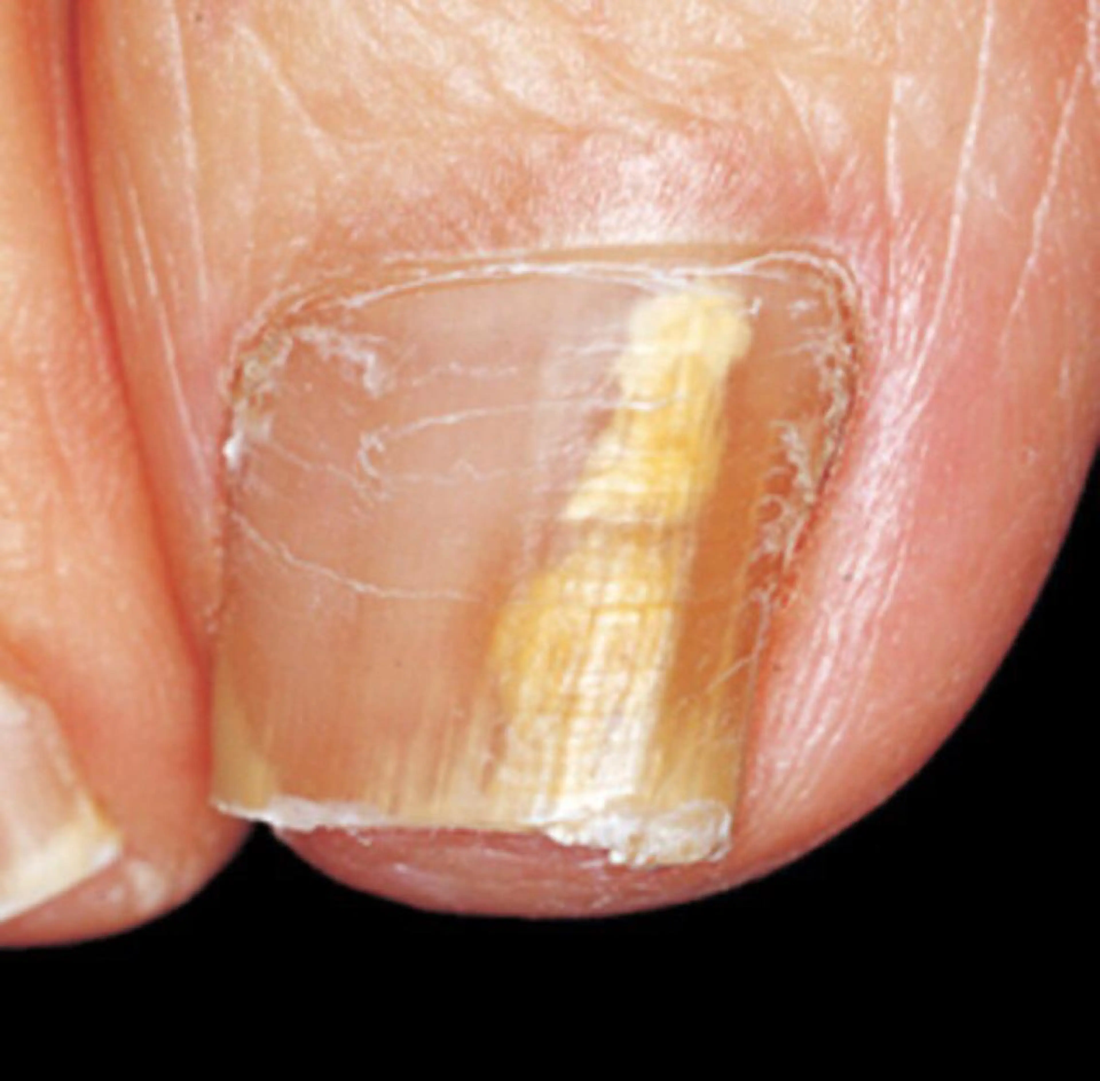 骨盤ダイエット痩身エステサロンBloom所属・坂田 真紀のエステ・リラクイメージ