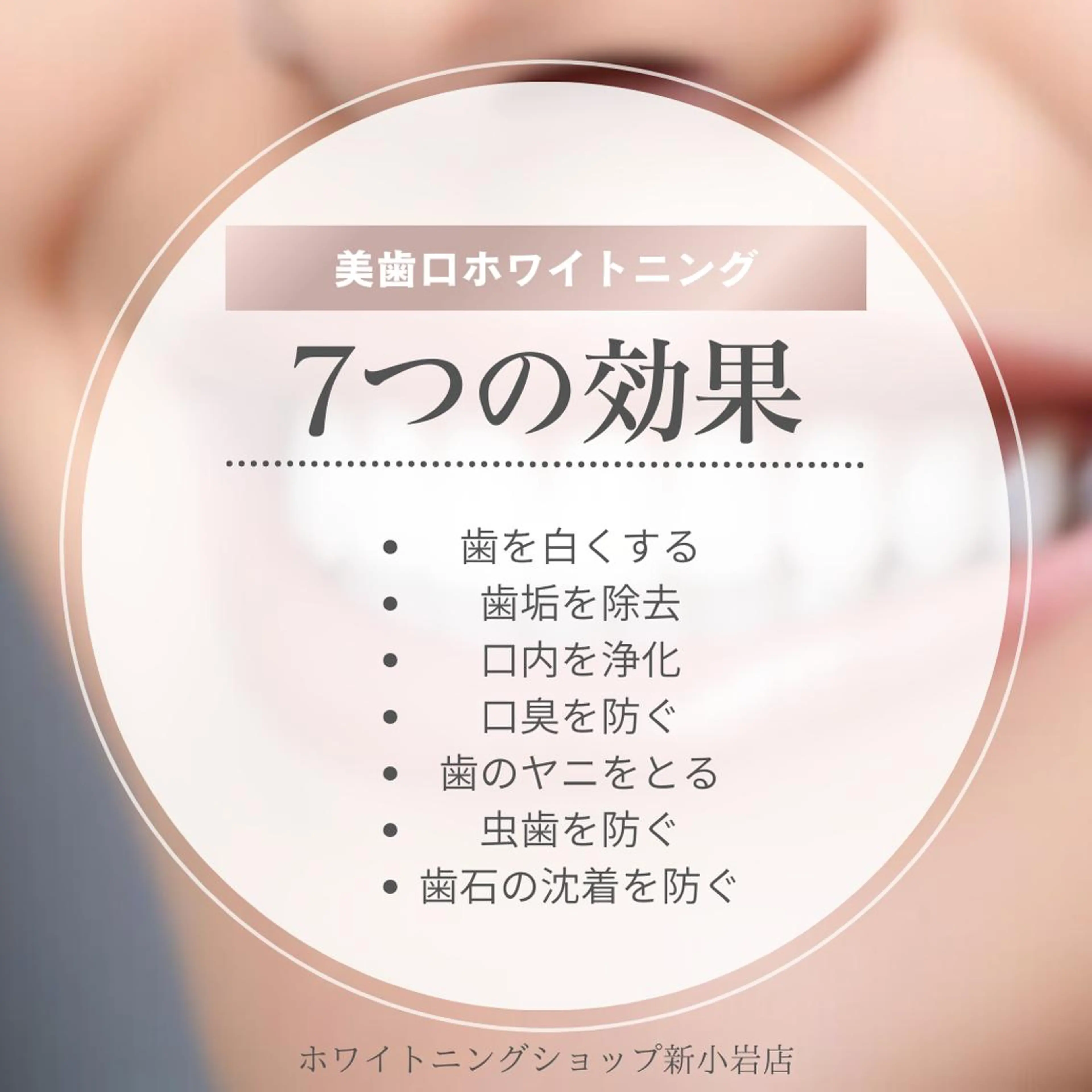 メンズ その他 ホワイトニング ショップ新小岩店のその他イメージ