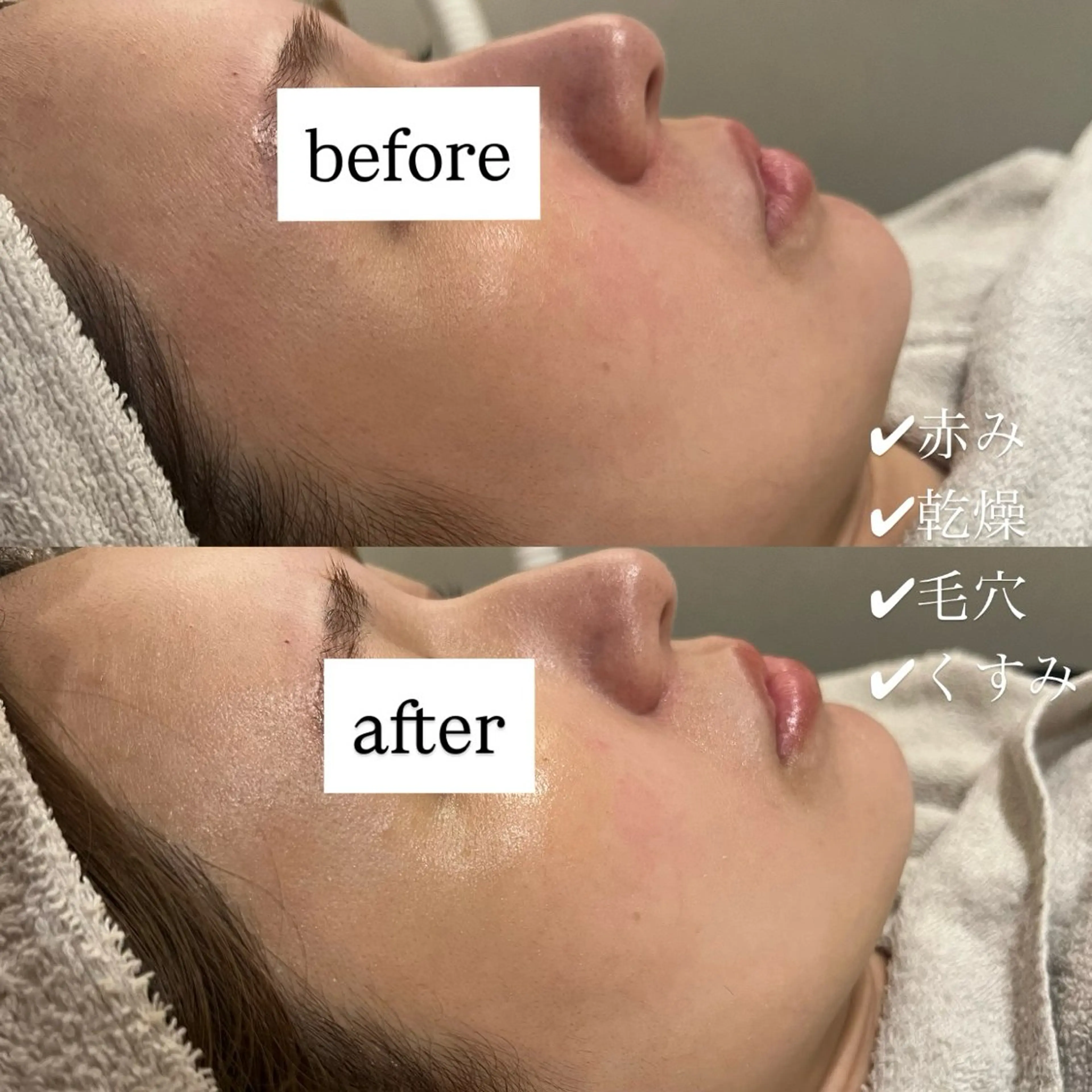 エステ リラク 【vidyto】ヴィディトゥ所属・肌管理サロン vidyto MOEのエステ・リラクイメージ