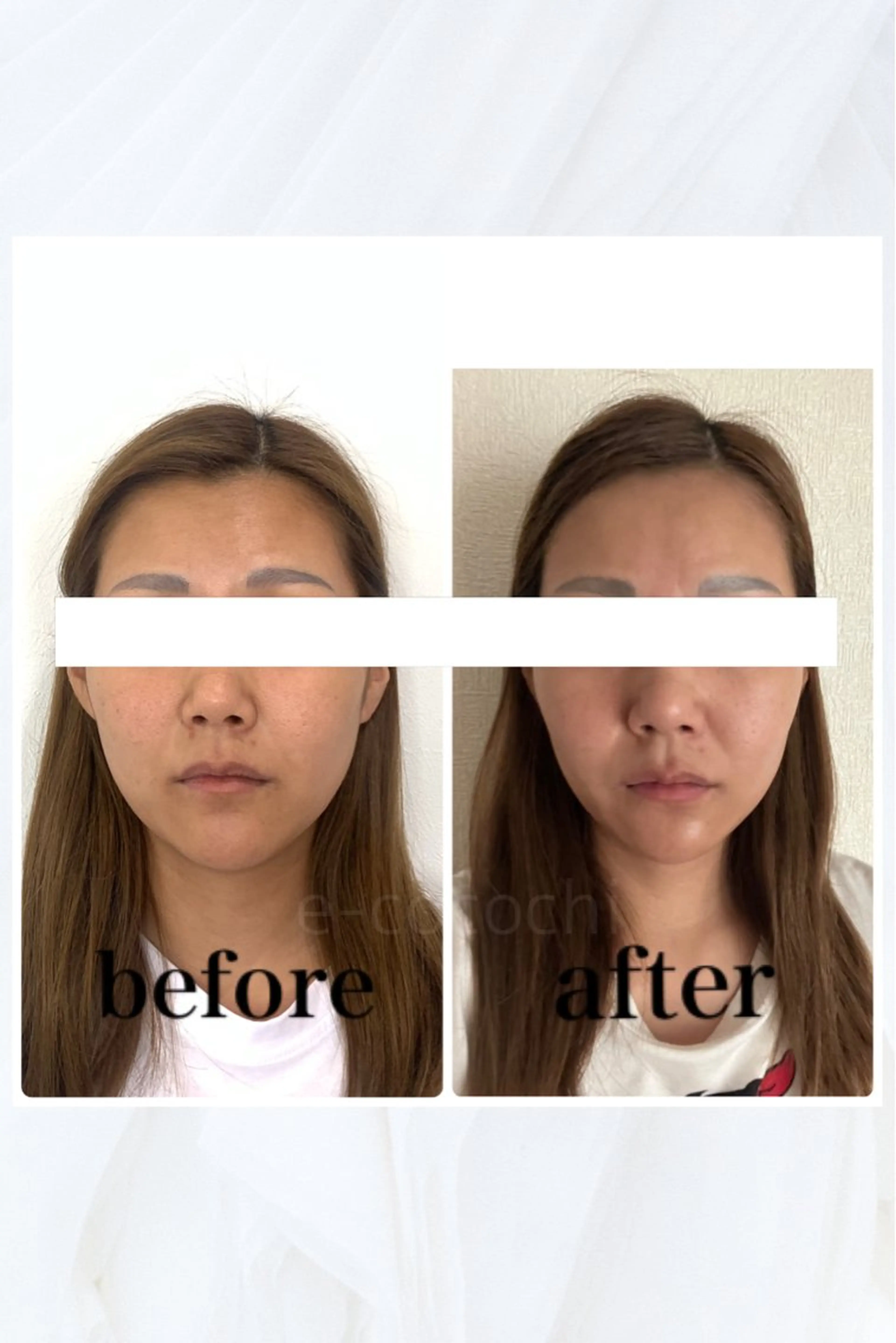 エステ リラク 小顔と ヘッドスパのお店のエステ・リラクイメージ