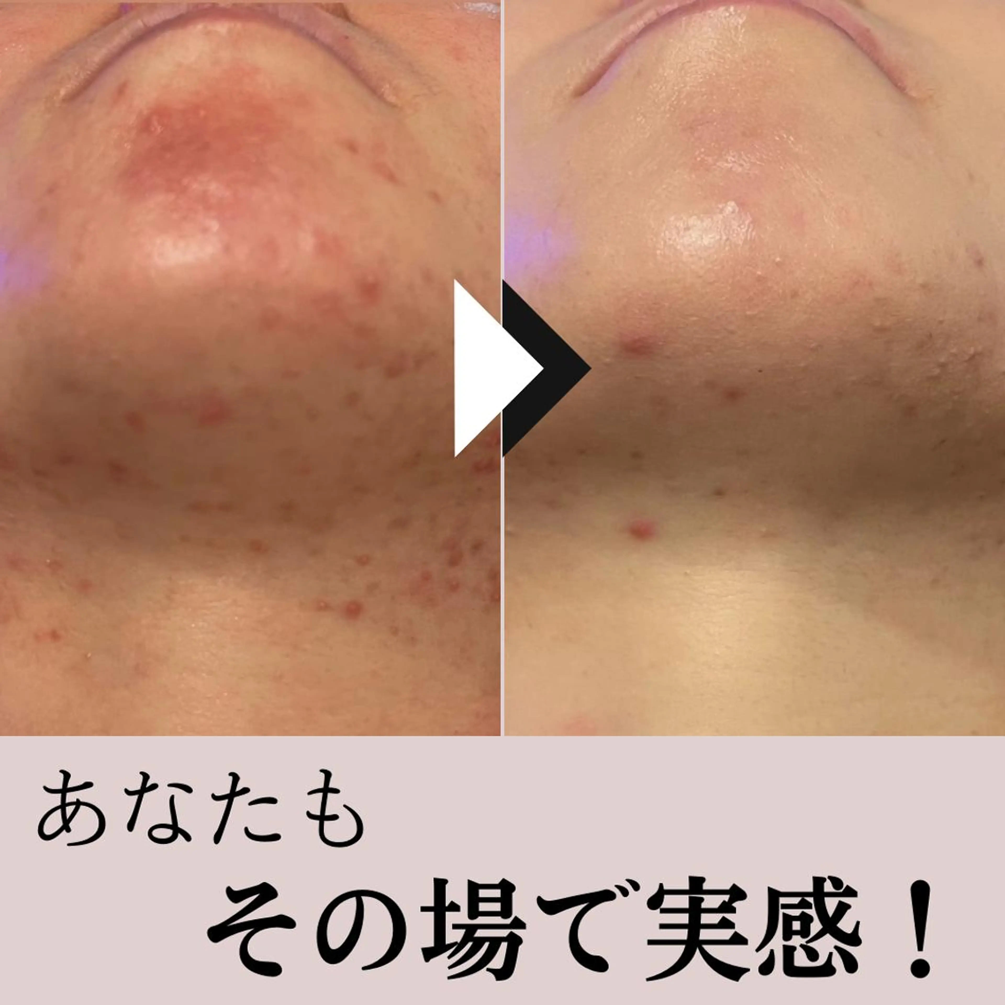 毛穴専門店Bébé 大阪中央店のエステ・リラクイメージ