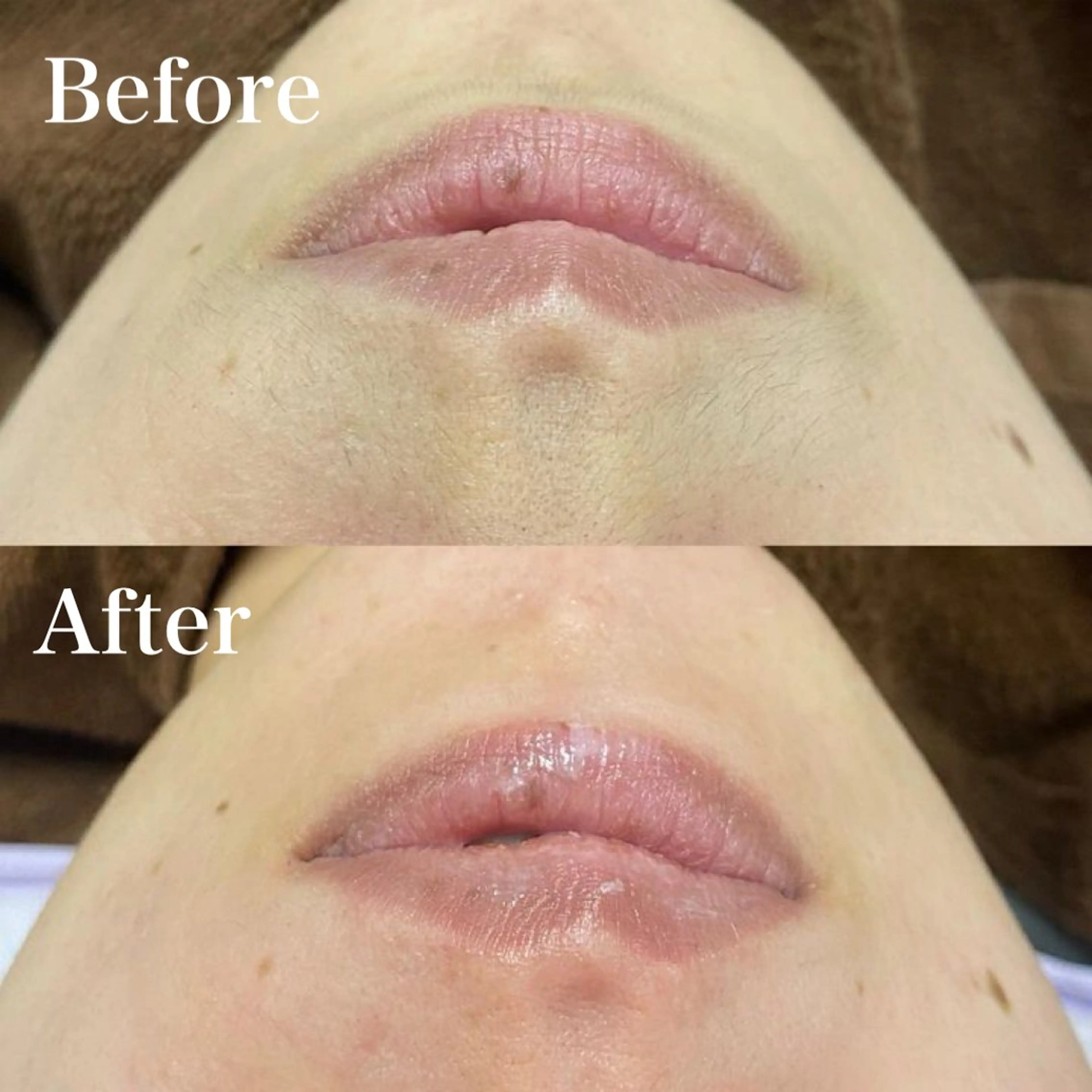 Mysarest 加藤のエステ・リラクイメージ