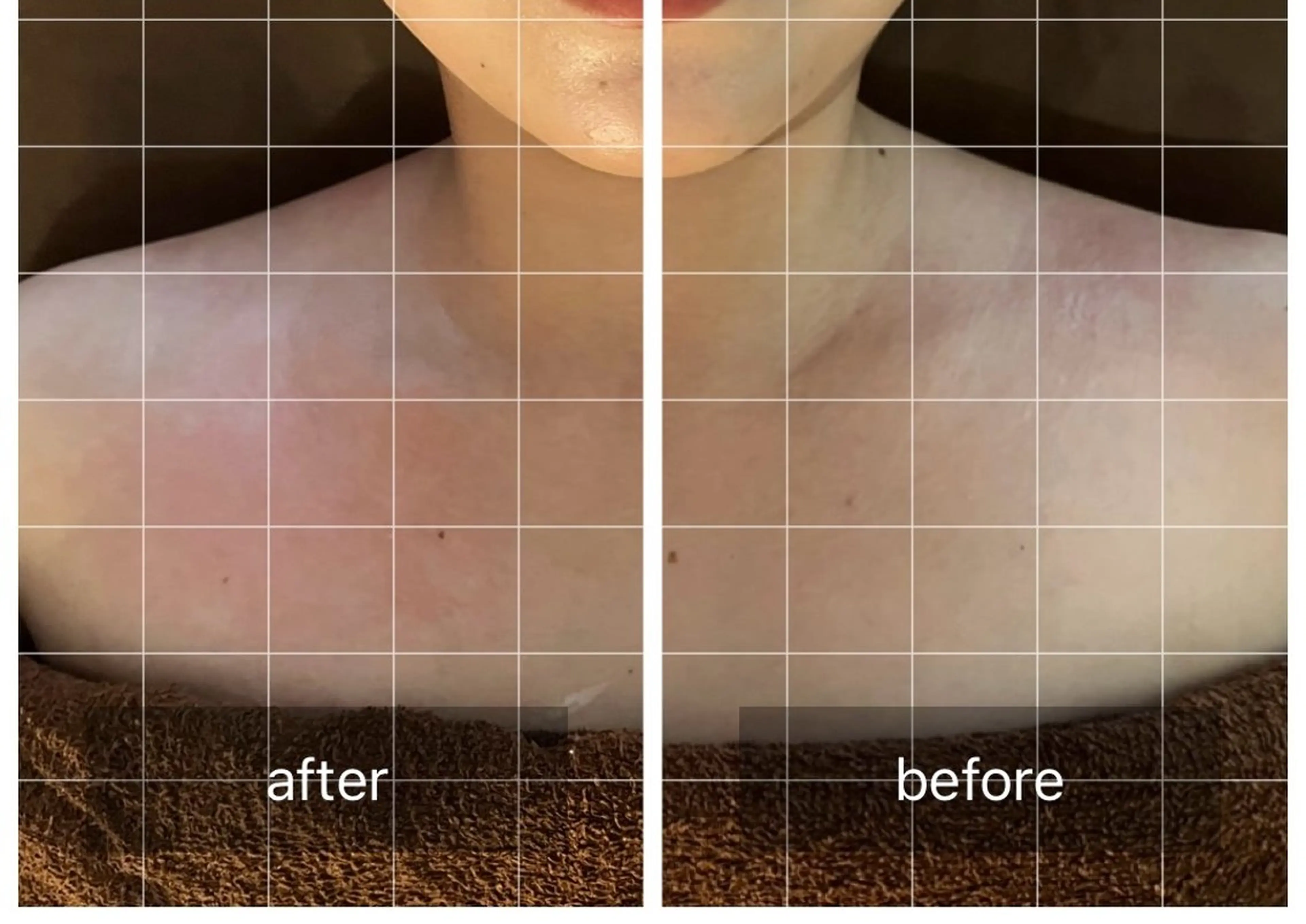 心斎橋痩身ダイエット 韓国.美容鍼.小顔のエステ・リラクイメージ