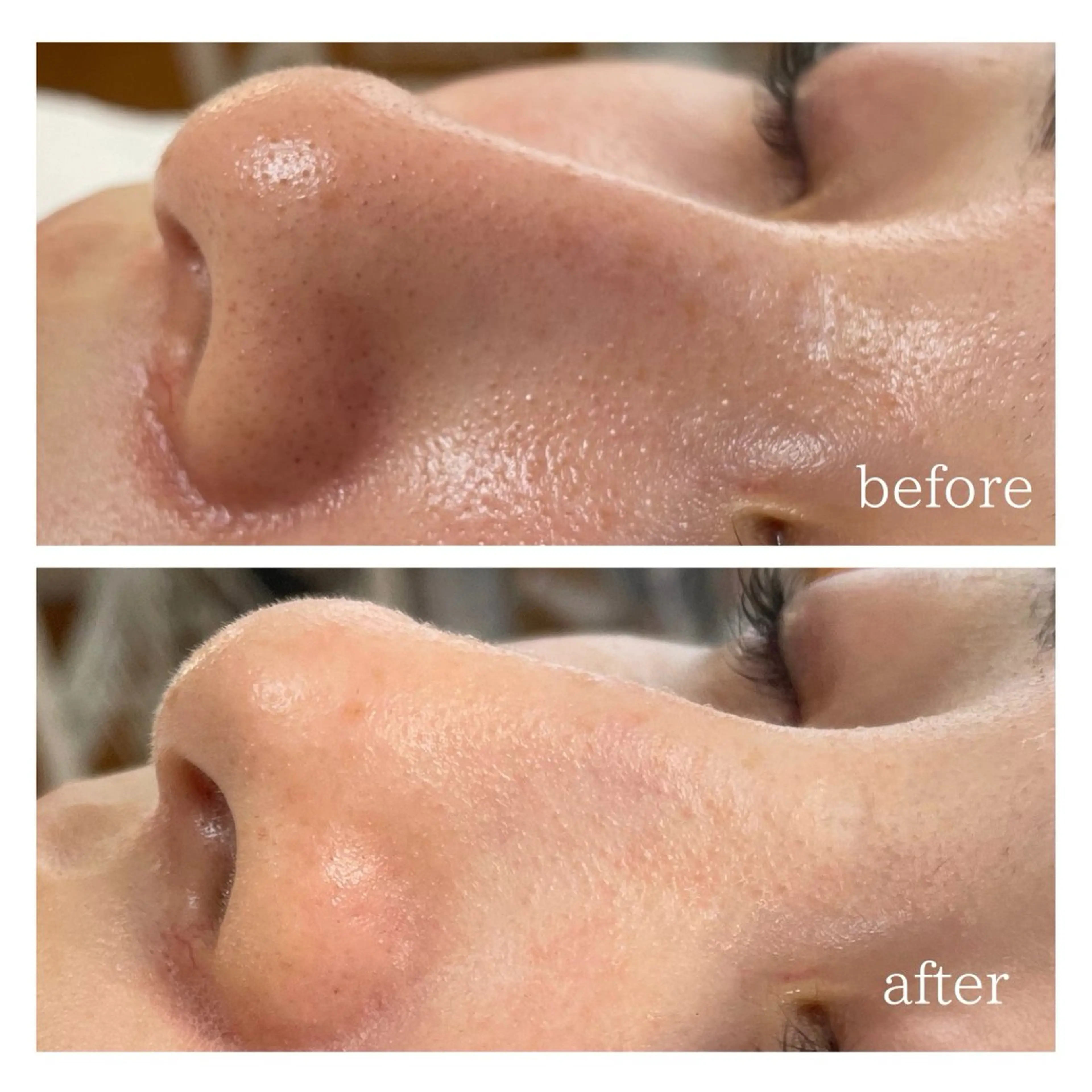 サロンピュア 所沢店のエステ・リラクイメージ