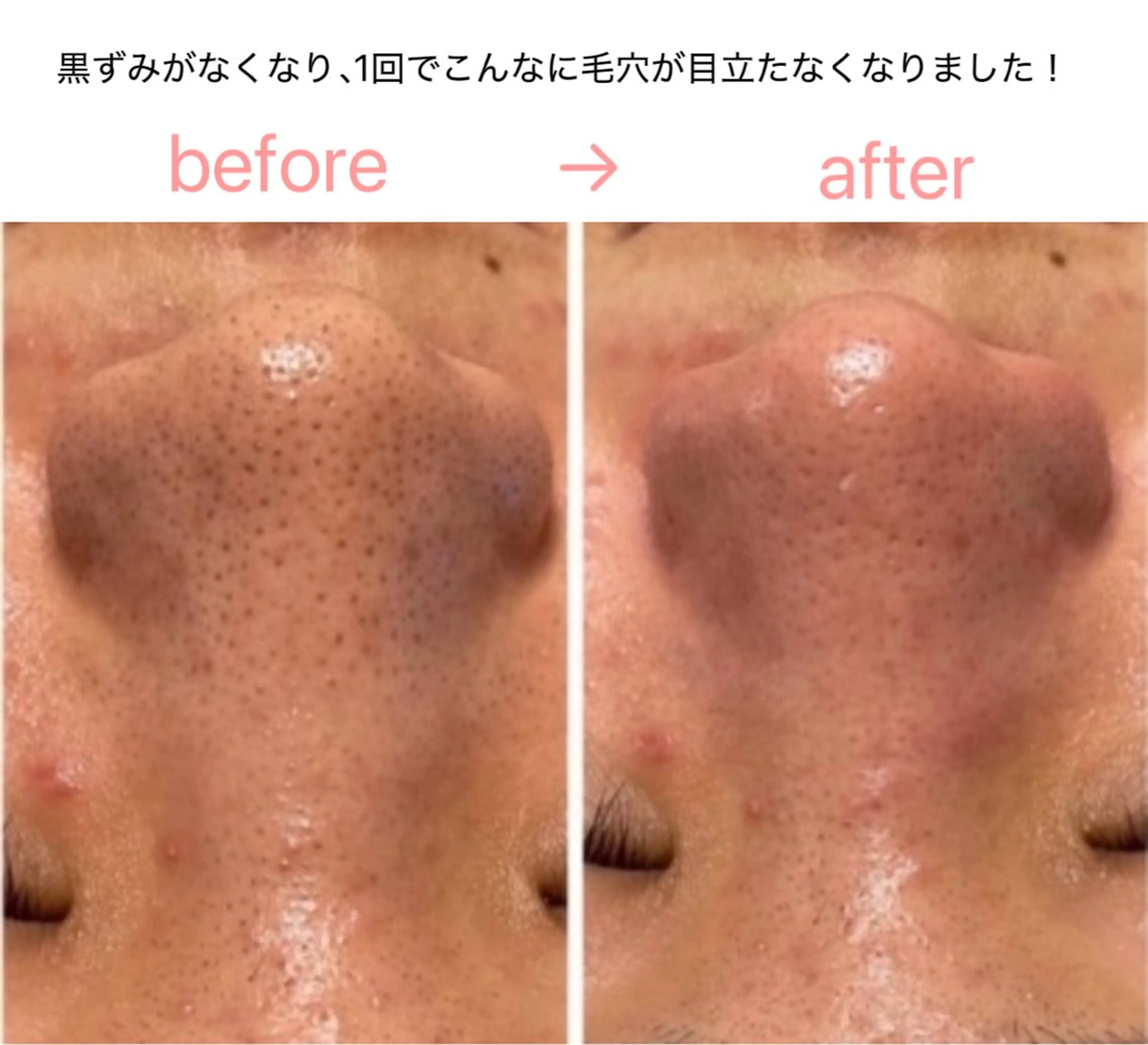 エステ Binosu所属・エンダモロジー BINOSUのその他イメージ