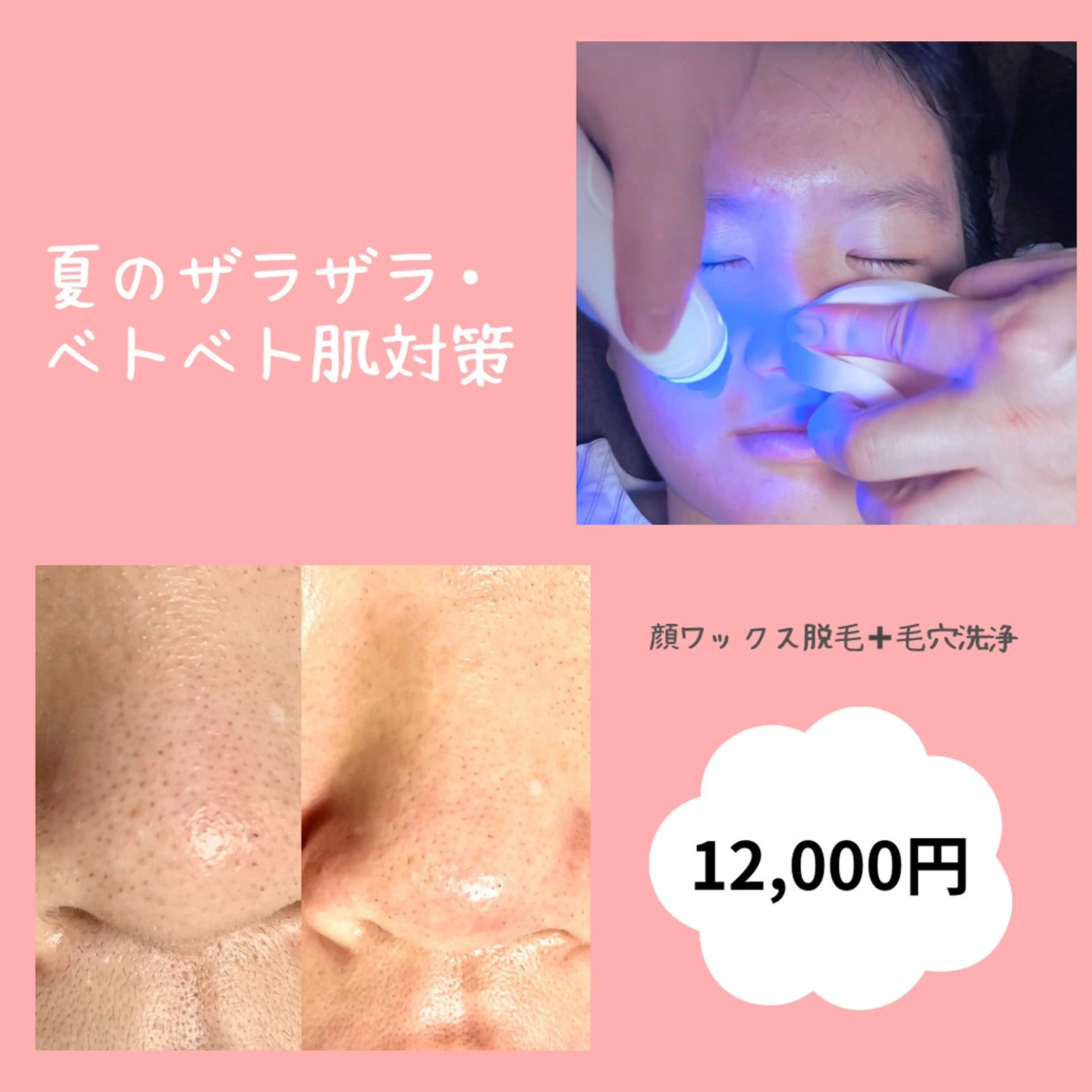 エステ La.pport ラポールのエステ・リラクイメージ