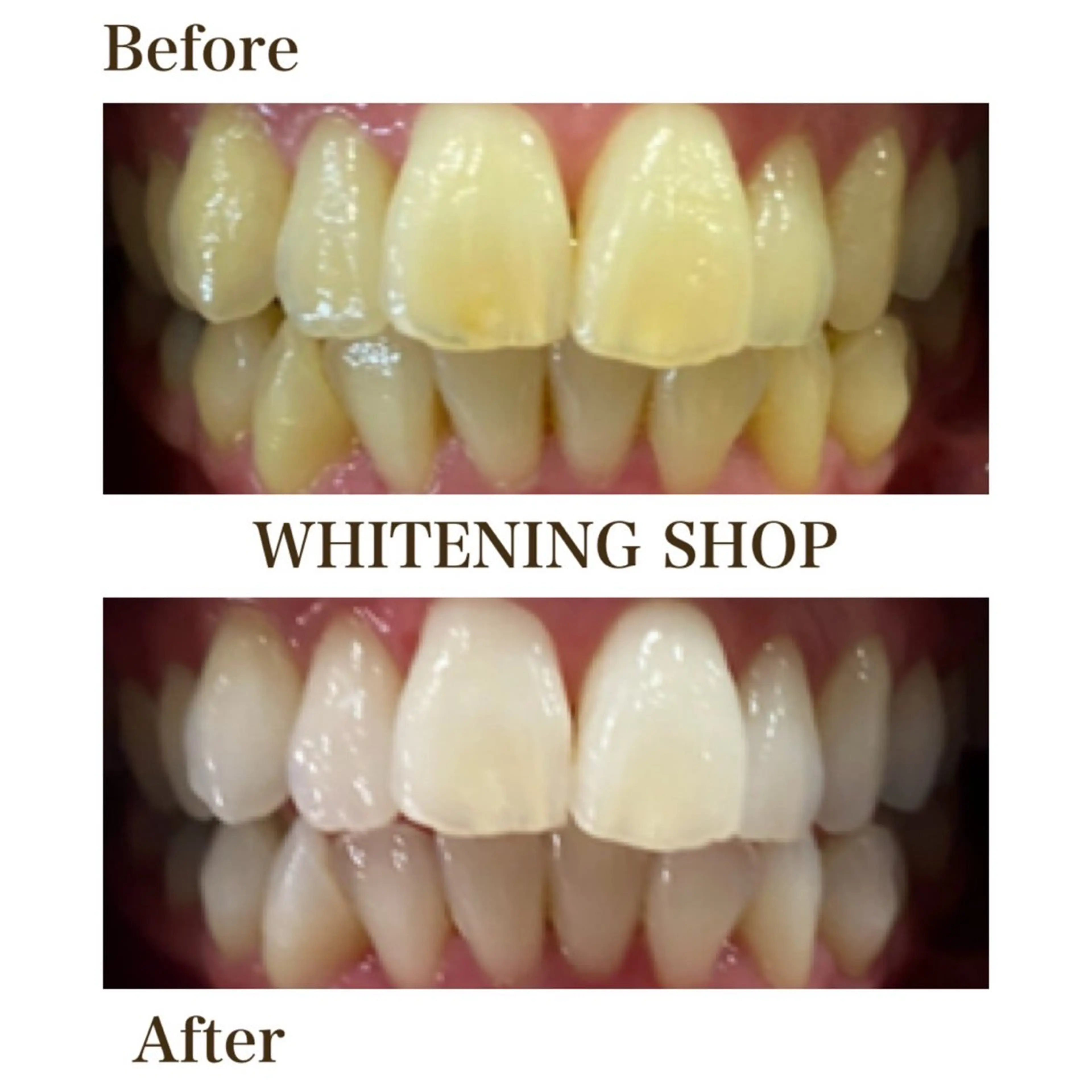 ホワイトニング ショップ川越店のエステ・リラクイメージ