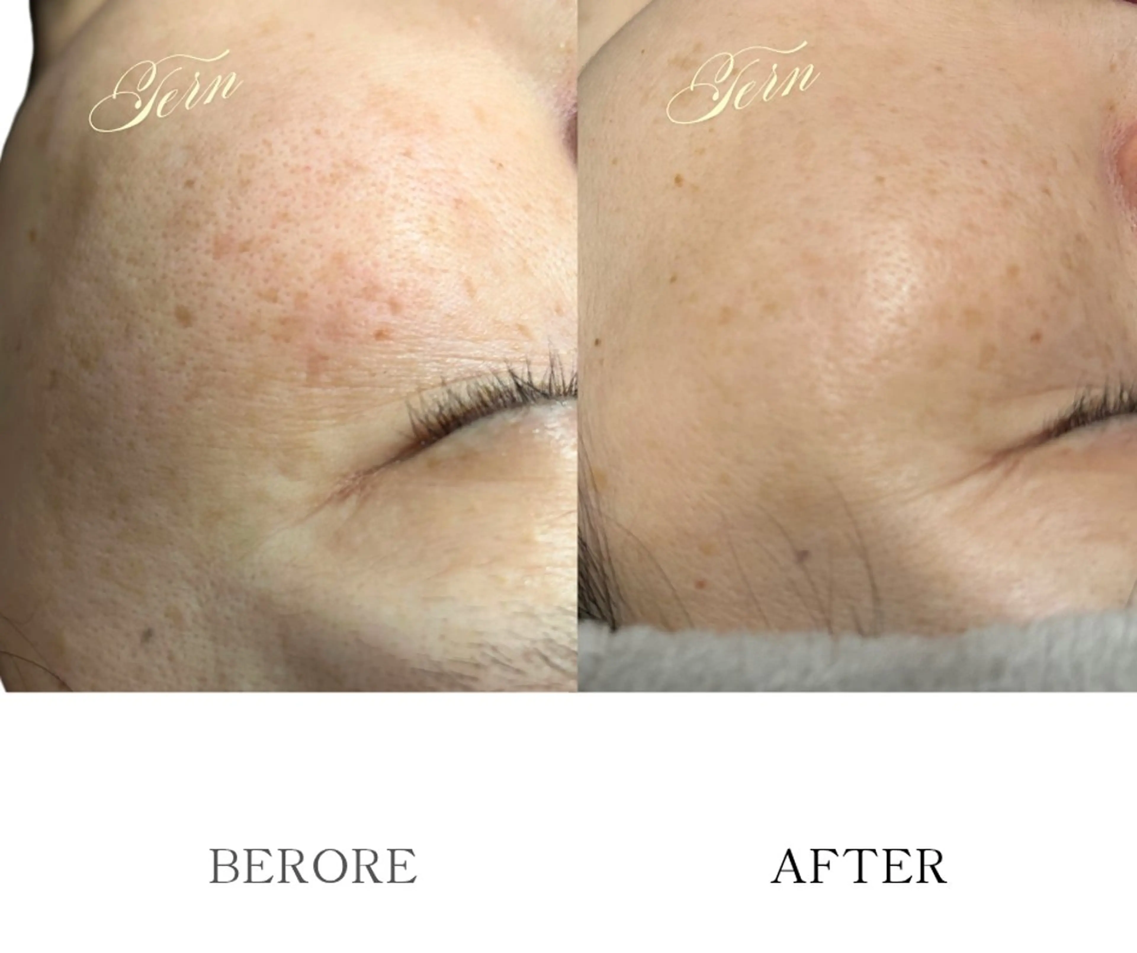 小顔・ニキビ・肌管理 TERN 南草津店のエステ・リラクイメージ