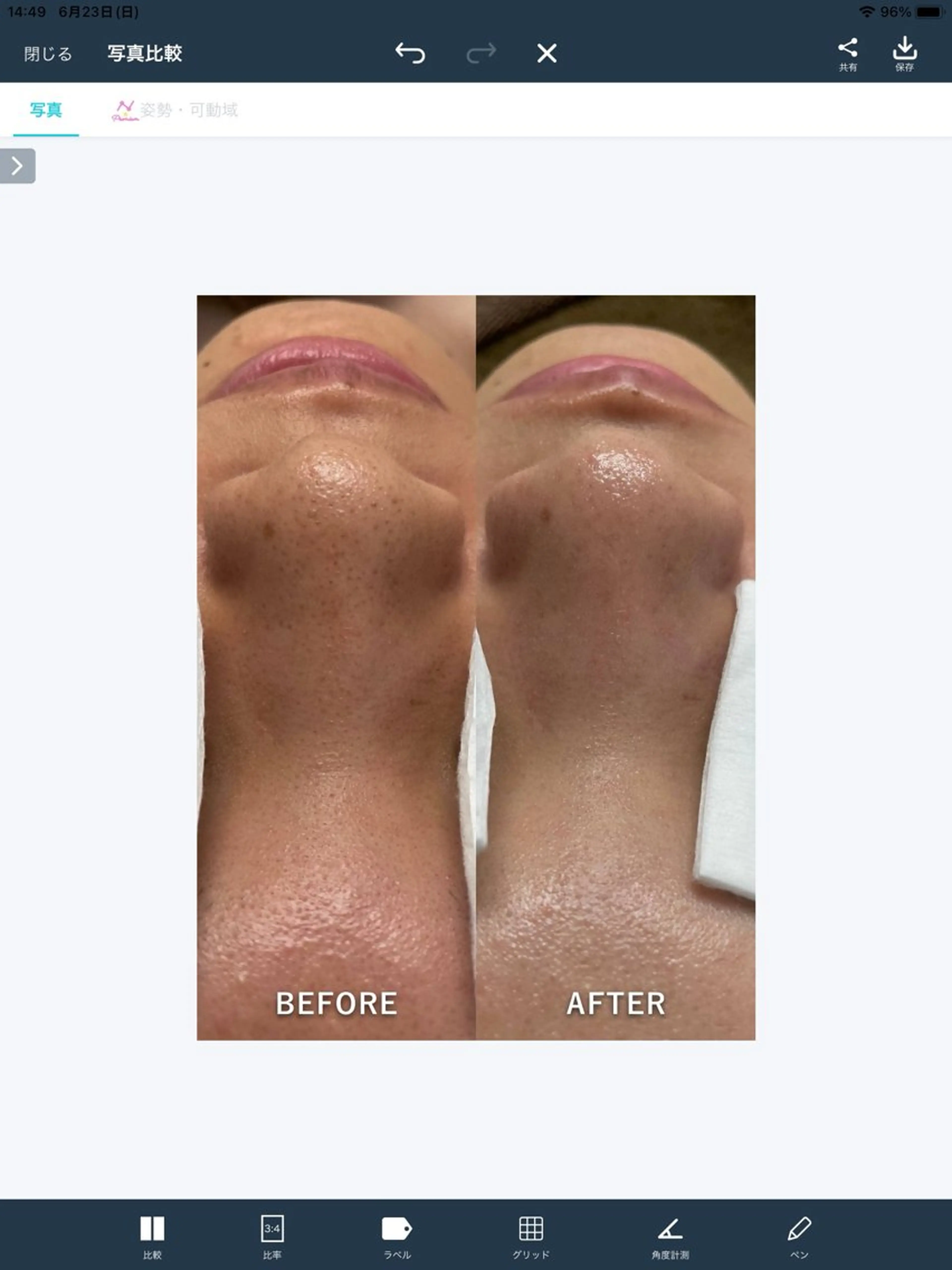 エステティック ロッカのエステ・リラクイメージ