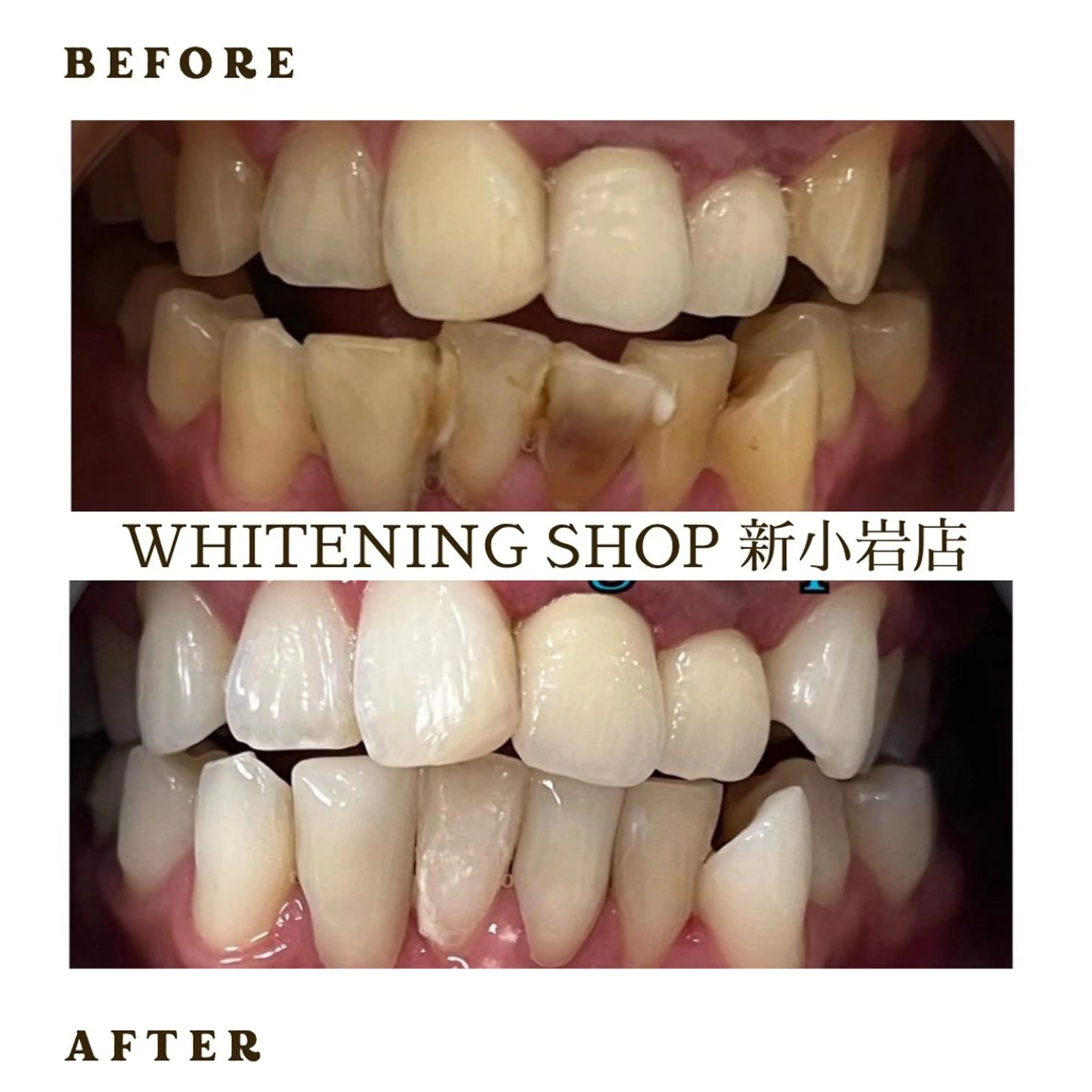 メンズ ホワイトニング ショップ新小岩店のその他イメージ