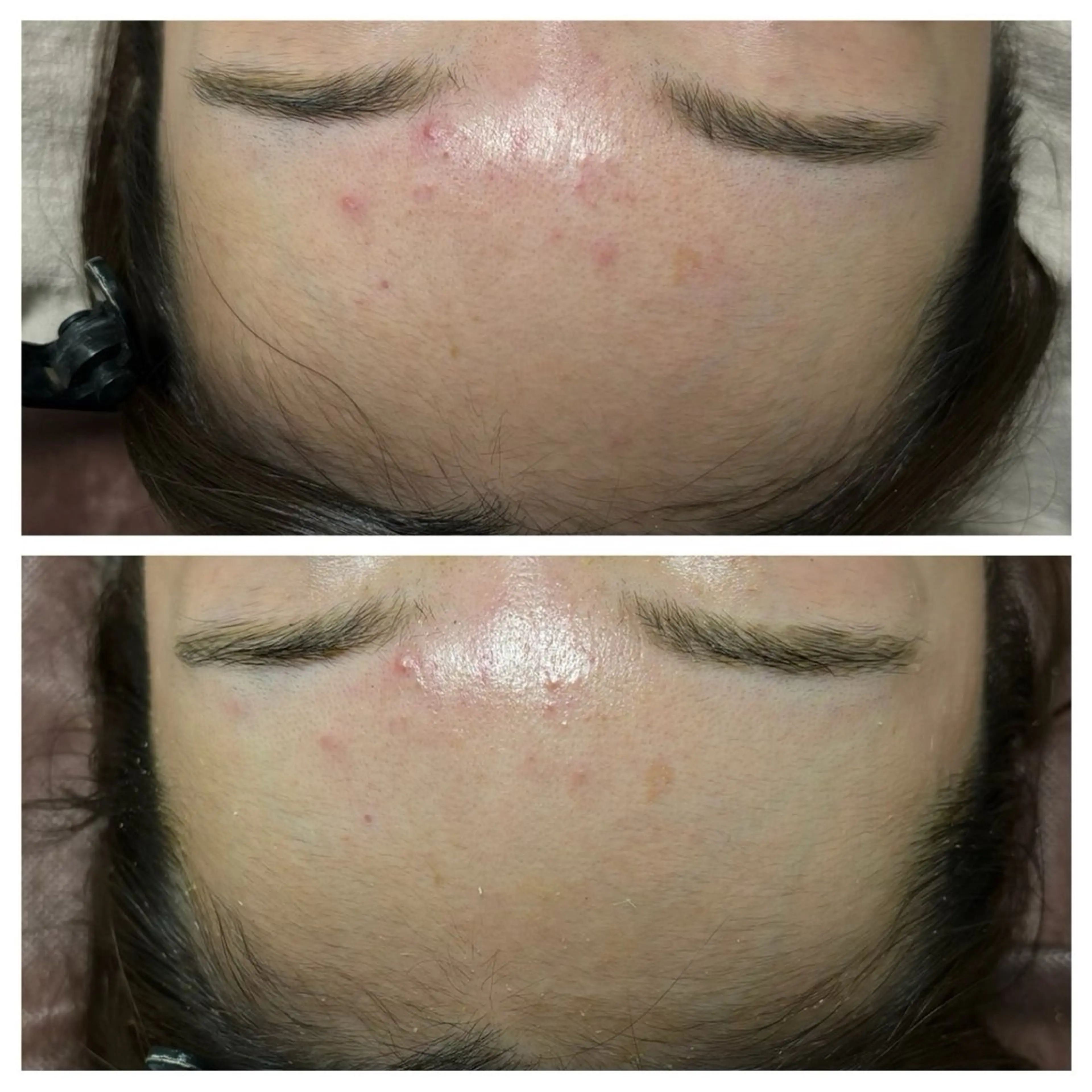 メンズ キッズ エステ ホワイトニングサロン プレジールのエステ・リラクイメージ