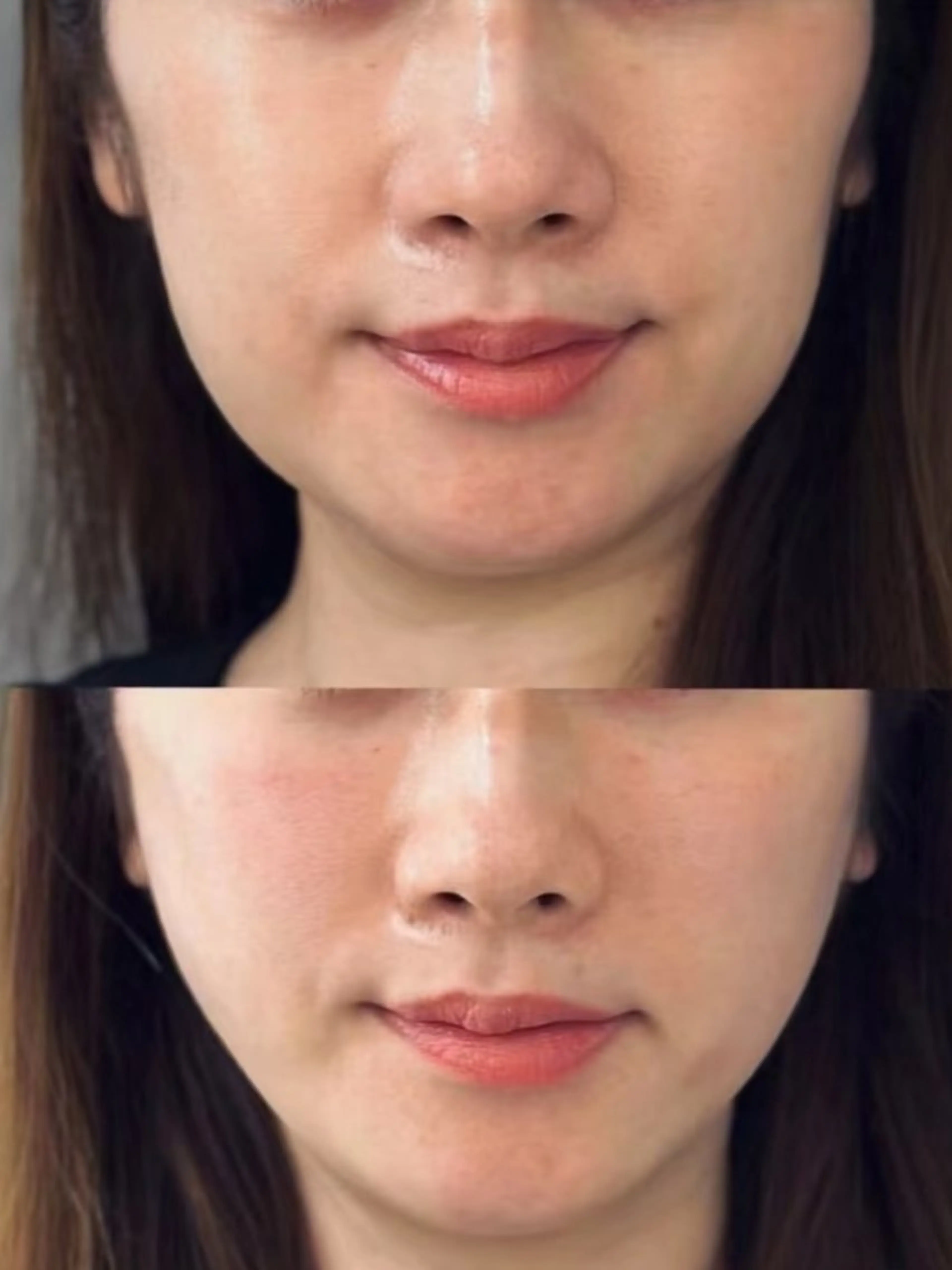 エステ aliaハイフ&水光ジェットサロン所属・aliaハーブ水光店 エステティシャン募集のエステ・リラクイメージ