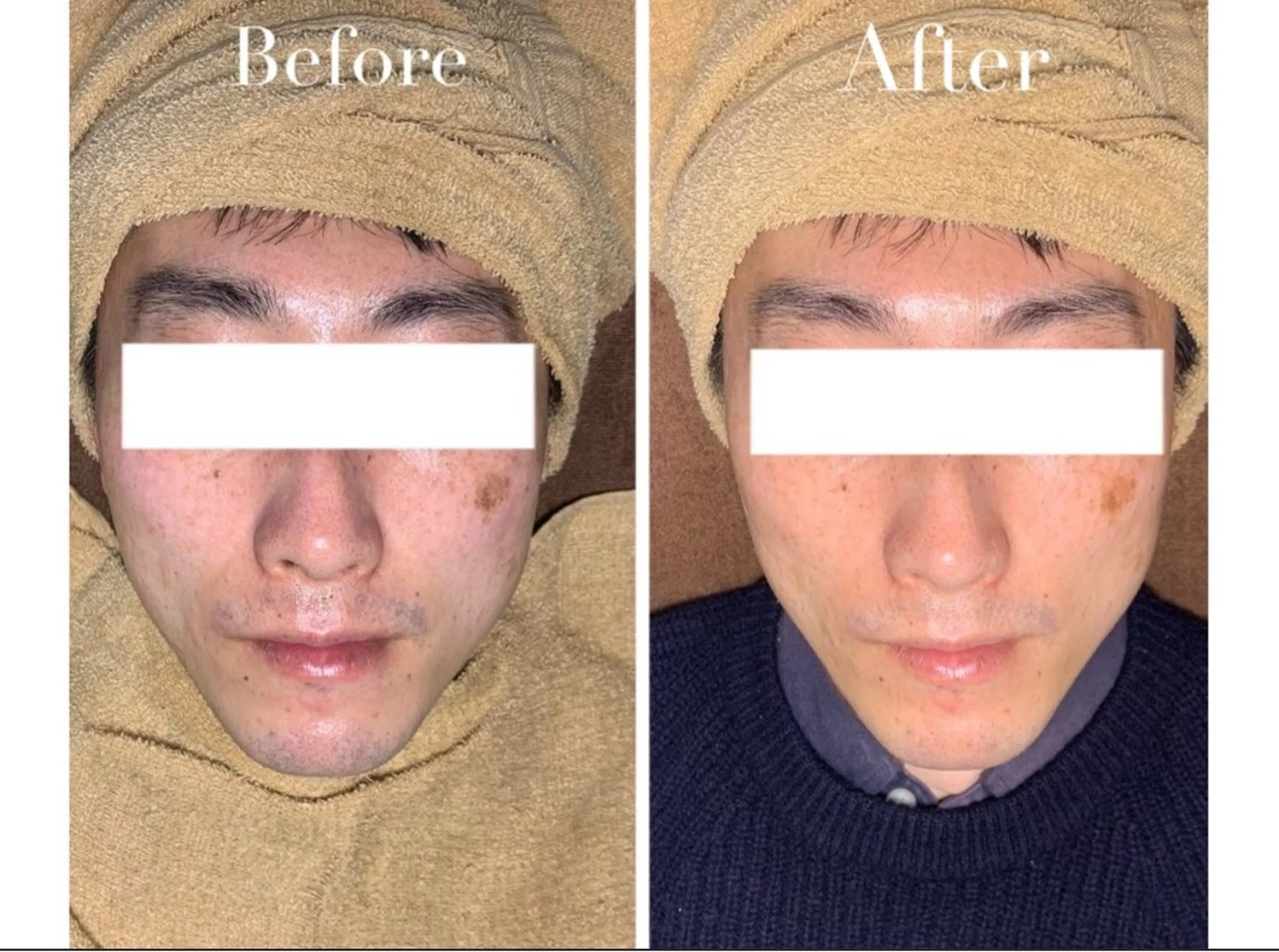 エステ Avenir Brillant所属・松田 紗季のエステ・リラクイメージ