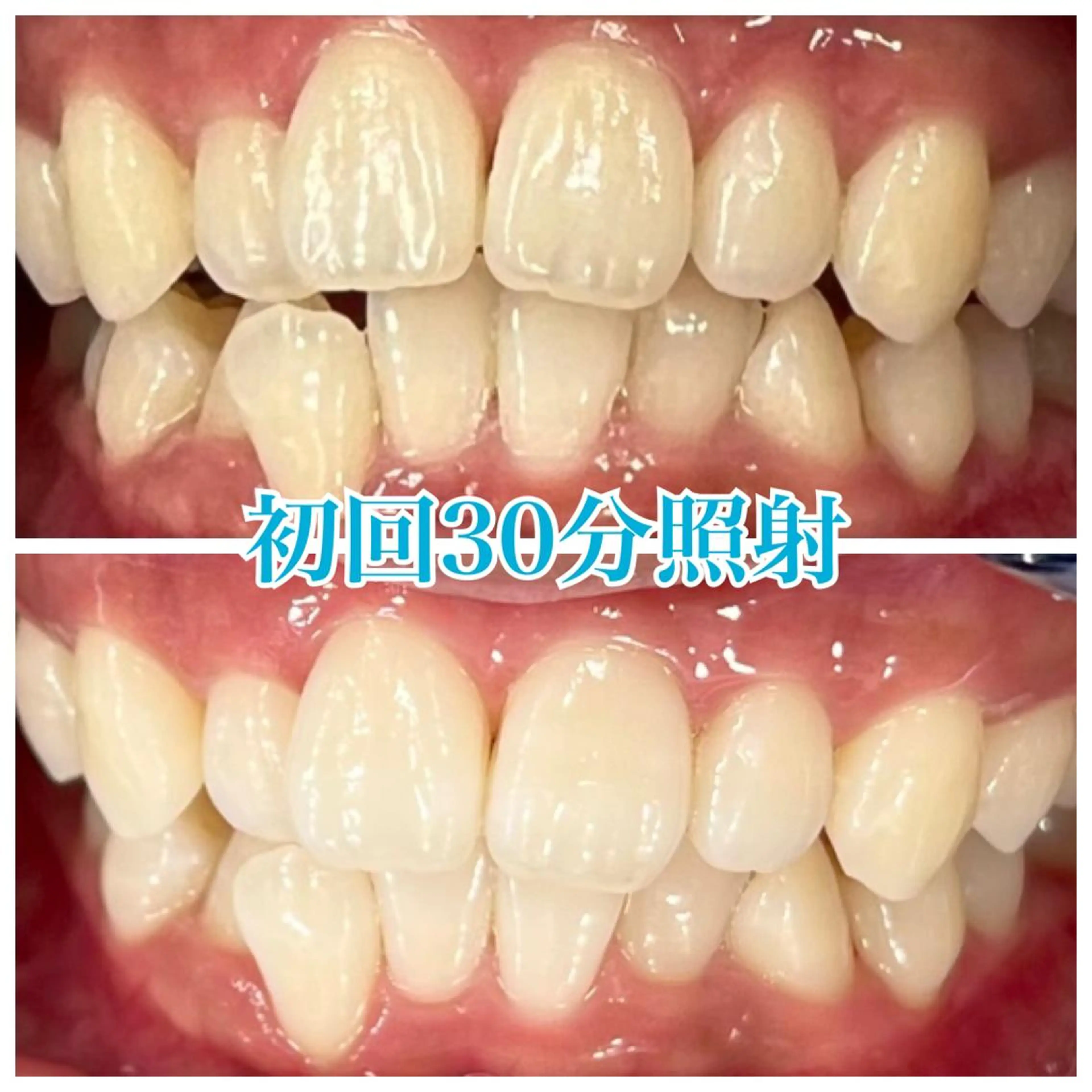 nailsalon   LE'A所属・ホワイトニング🦷 ネイル💅LEAのその他イメージ