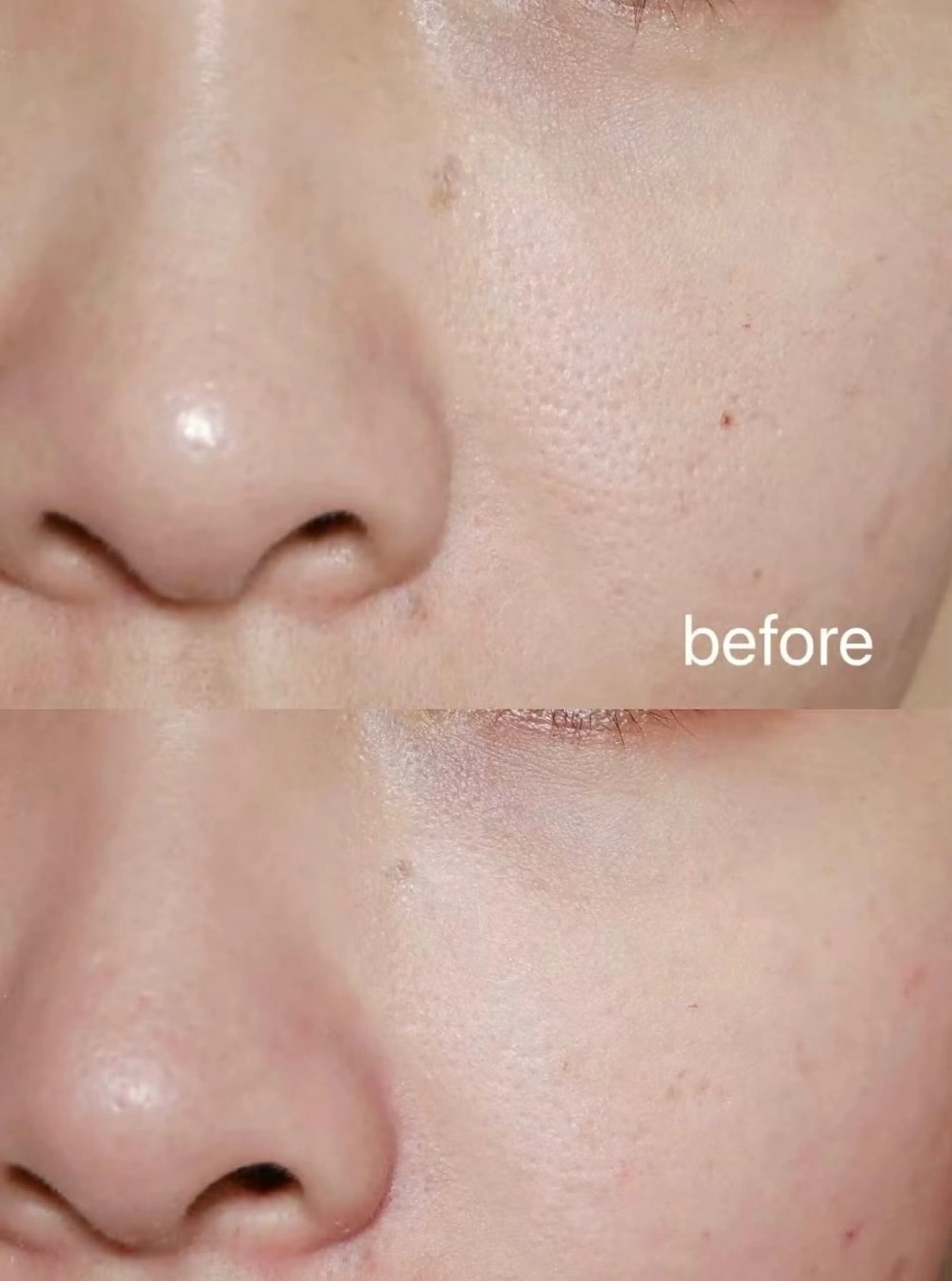 マツエク・マツパ エステ aliaハイフ&水光ジェットサロン所属・aliaハーブ水光店 エステティシャン募集のエステ・リラクイメージ