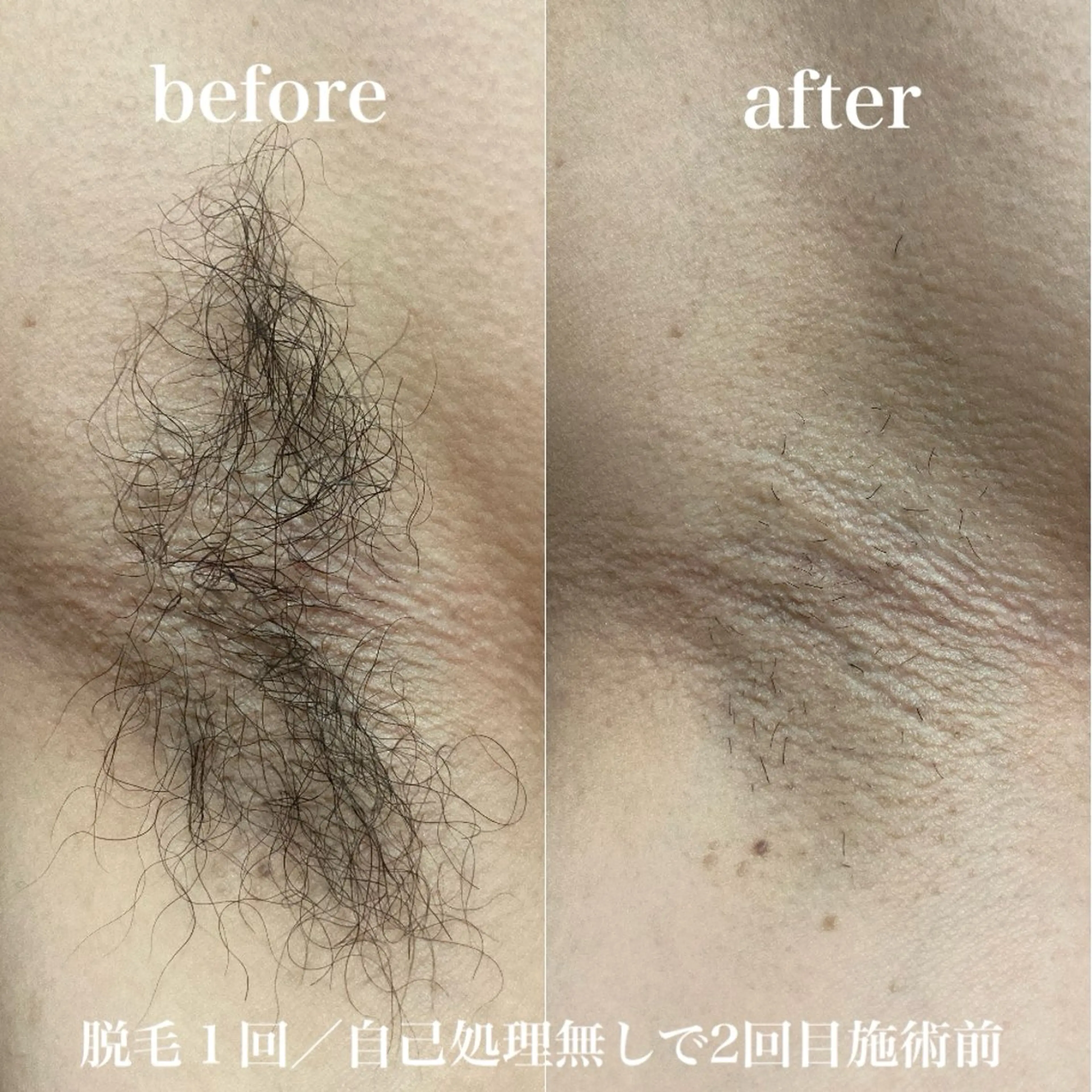 脱毛 磐田｜LAYLA 一番丁寧な脱毛店のエステ・リラクイメージ