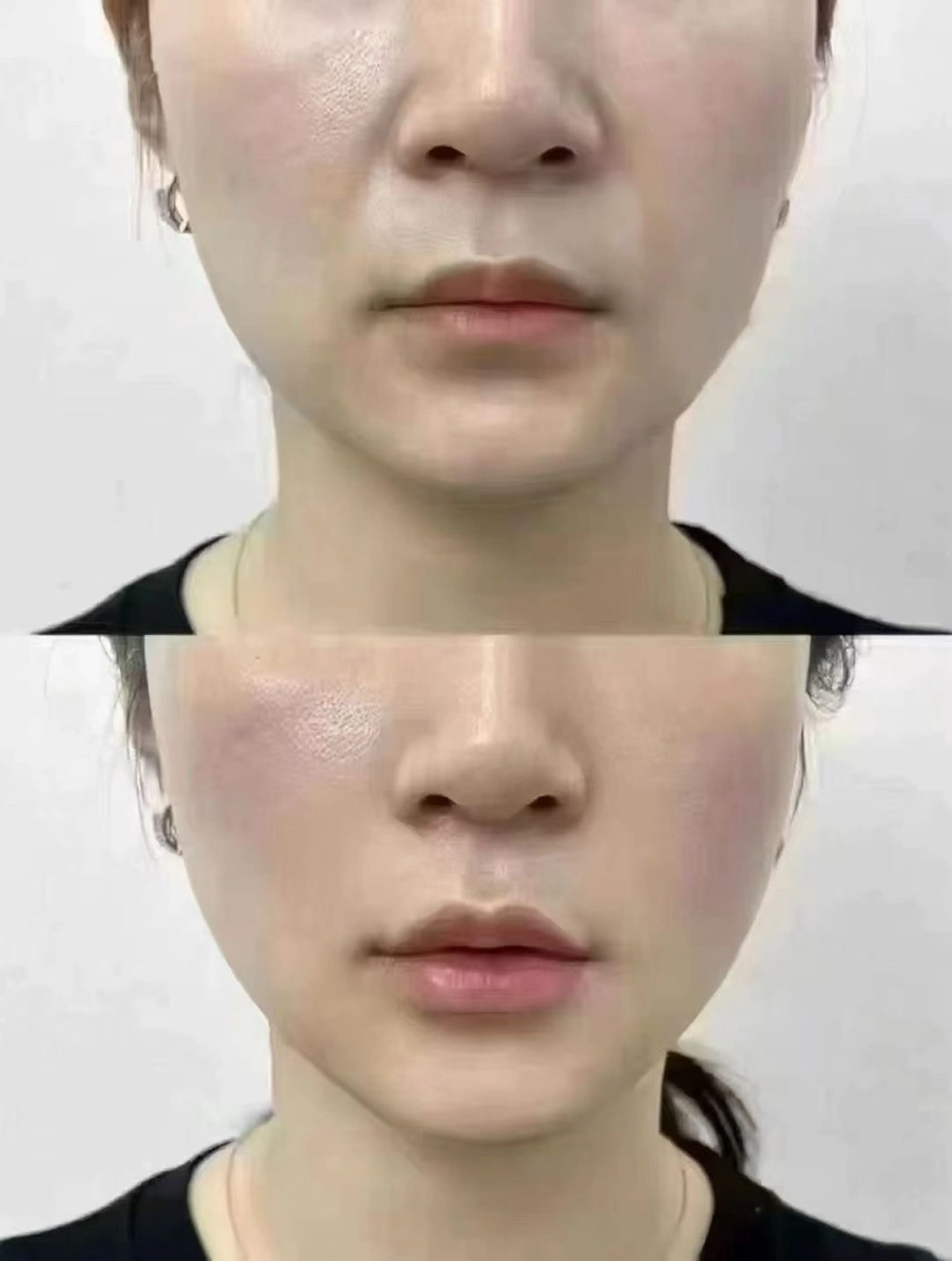 ネイル エステ aliaハイフ&水光ジェットサロン所属・aliaハーブ水光店 エステティシャン募集のエステ・リラクイメージ