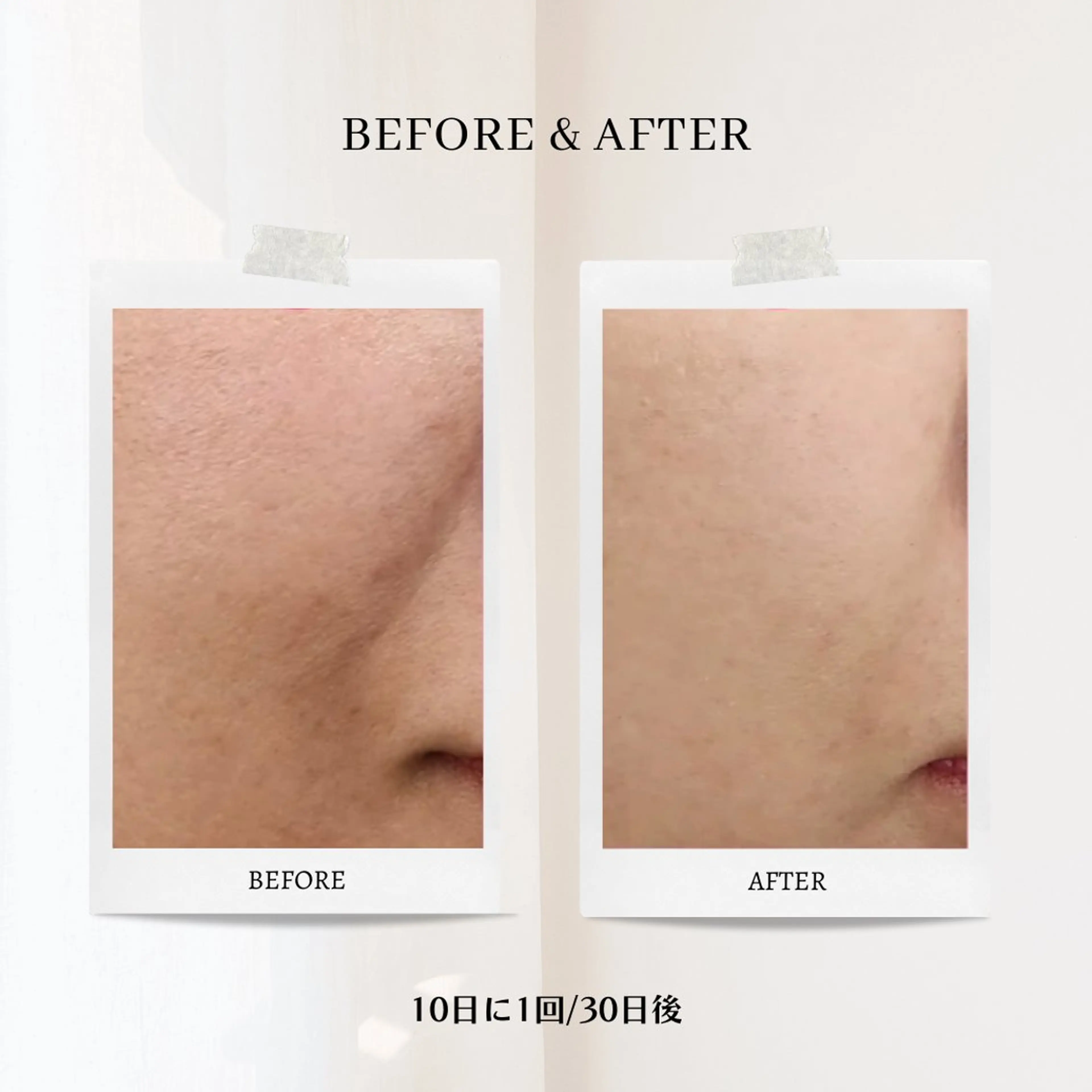 CHILO 銀座店のエステ・リラクイメージ