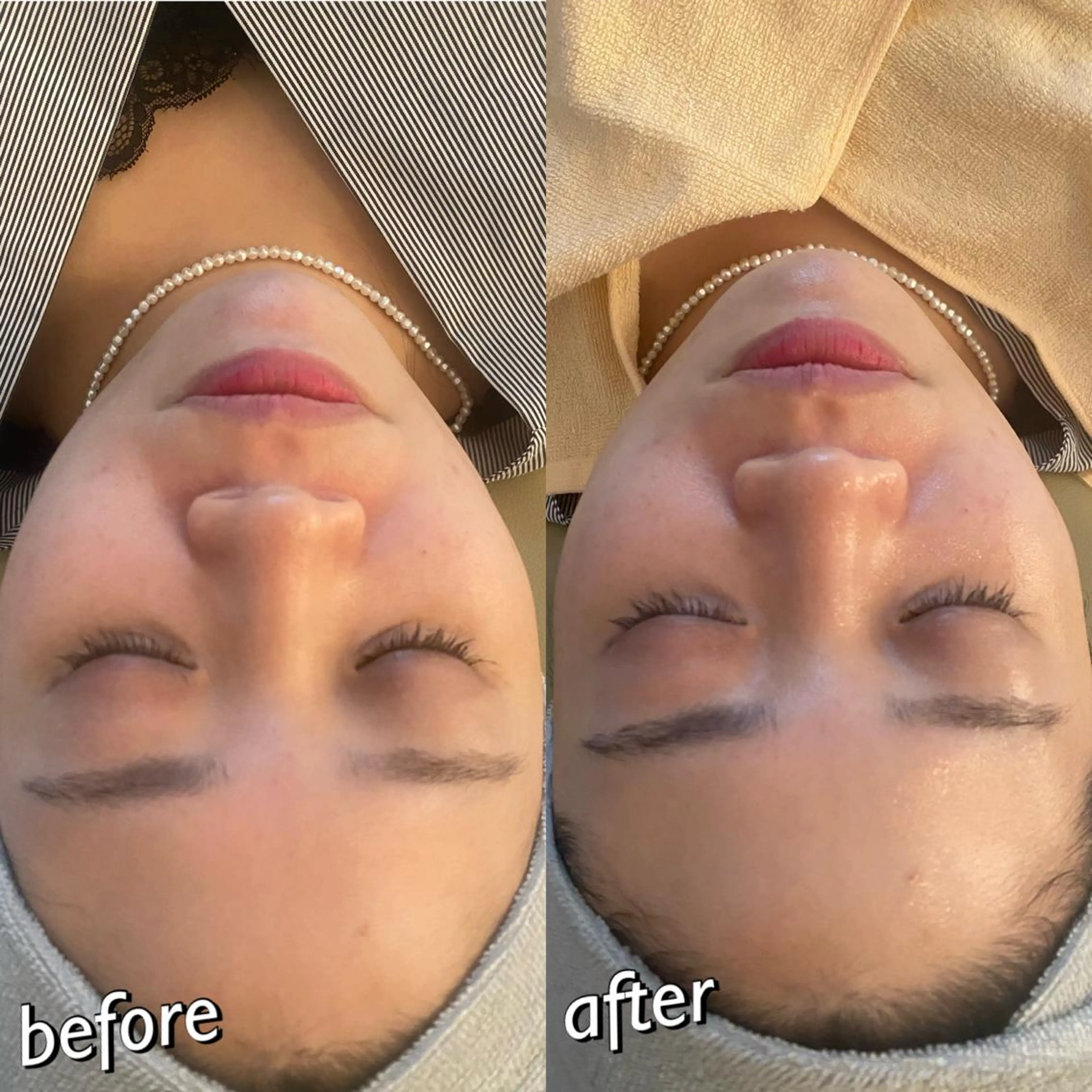 うなじ脱毛/美肌脱毛 LABELのエステ・リラクイメージ