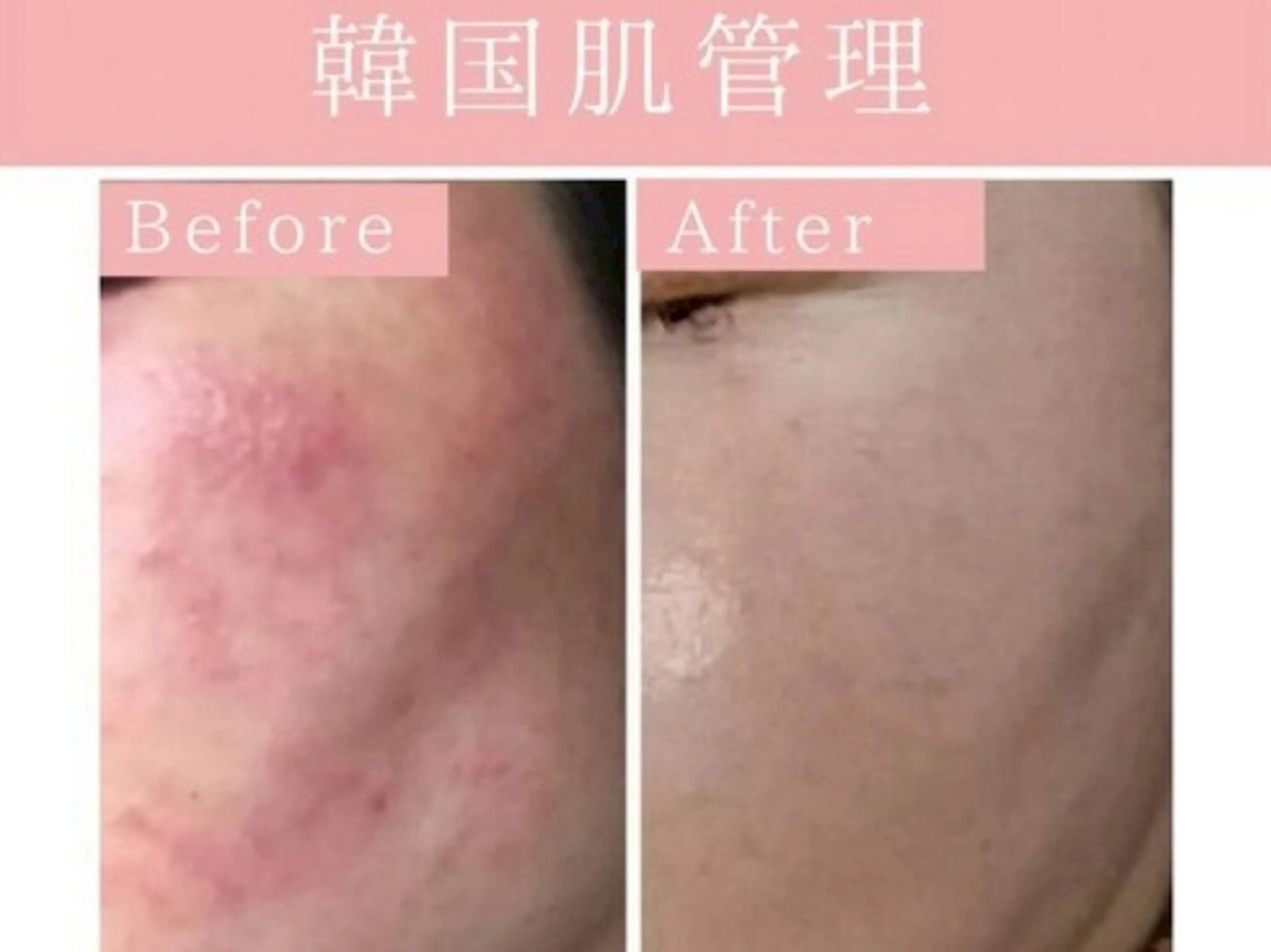 REMENTE池袋東口店所属・REMENTE🪞 KANAのエステ・リラクイメージ